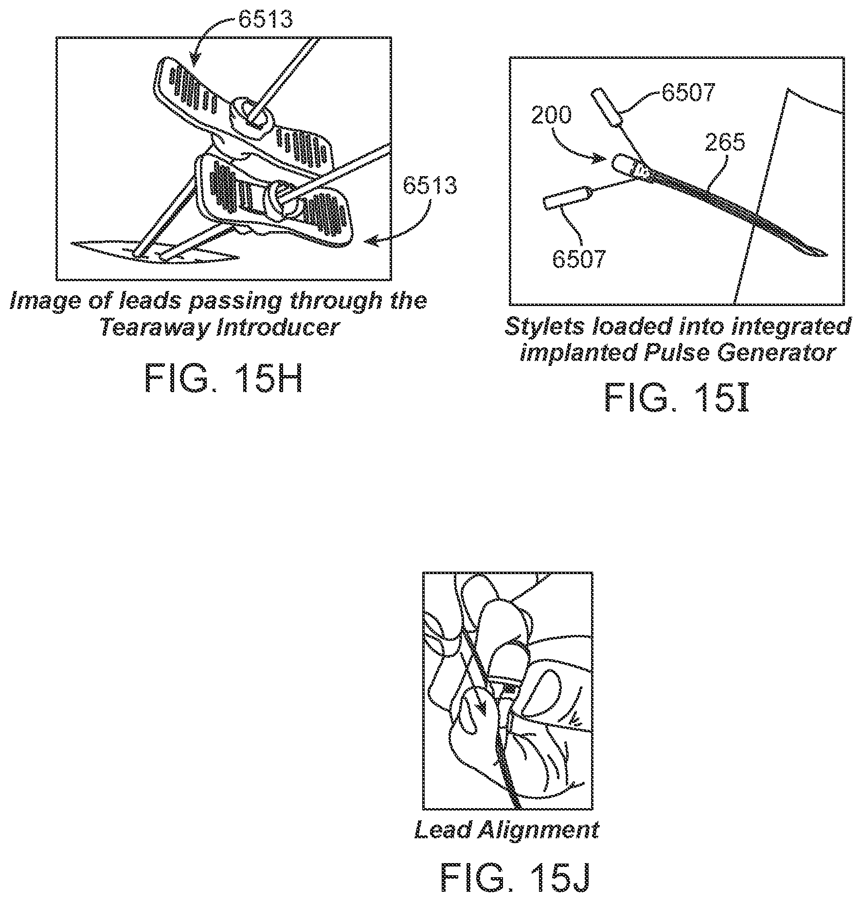 Patent US12551710 Figure 19 – Stimulation apparatus