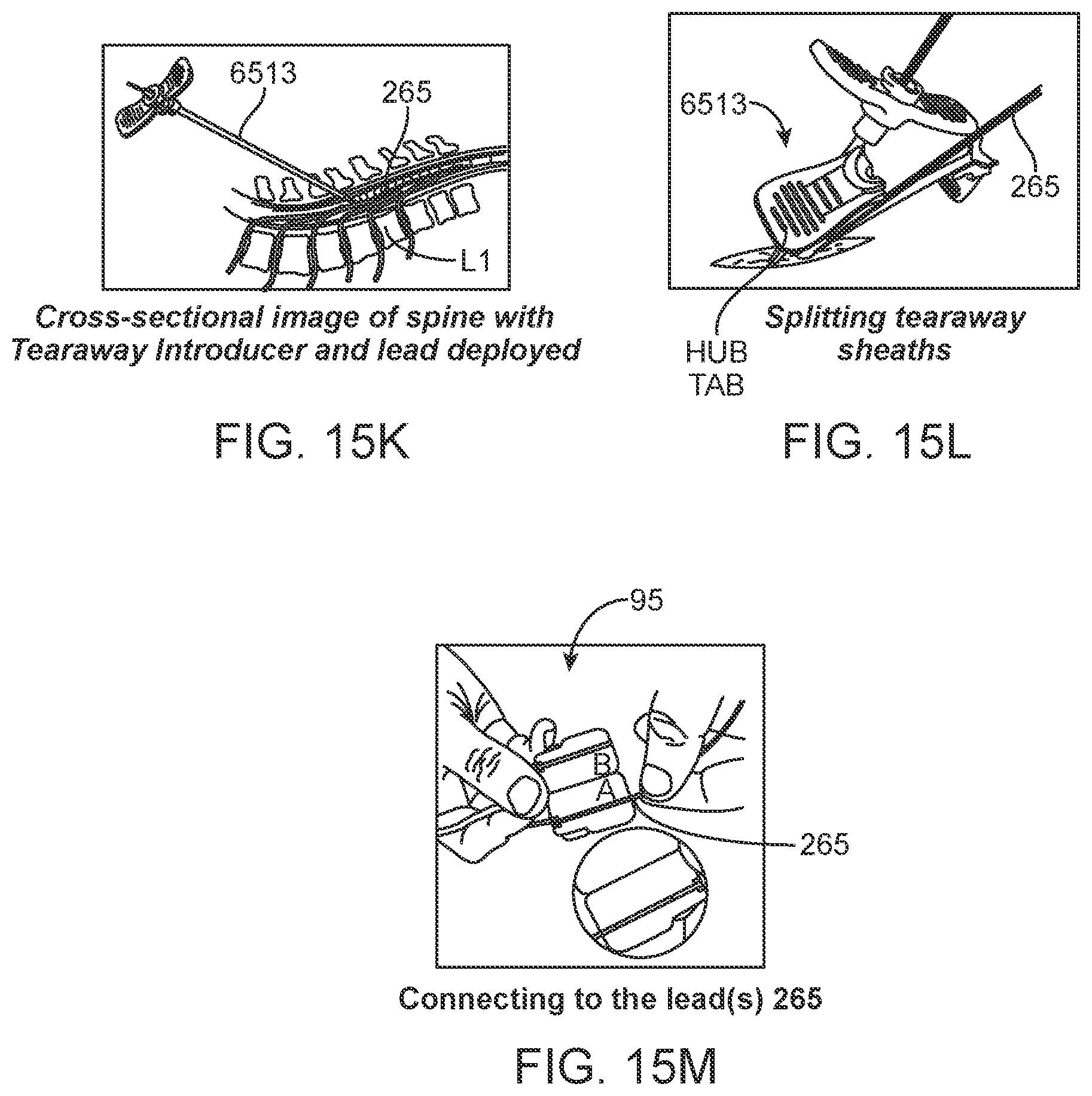 Patent US12551710 Figure 20 – Stimulation apparatus
