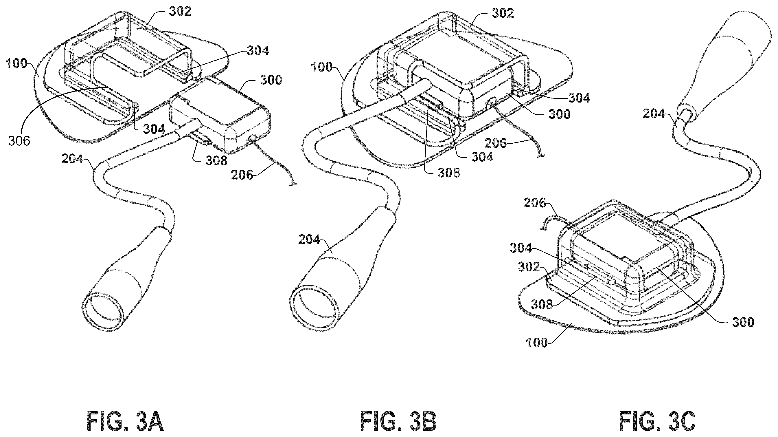Patent US12551711 Figure 3 – Stimulation lead connection system