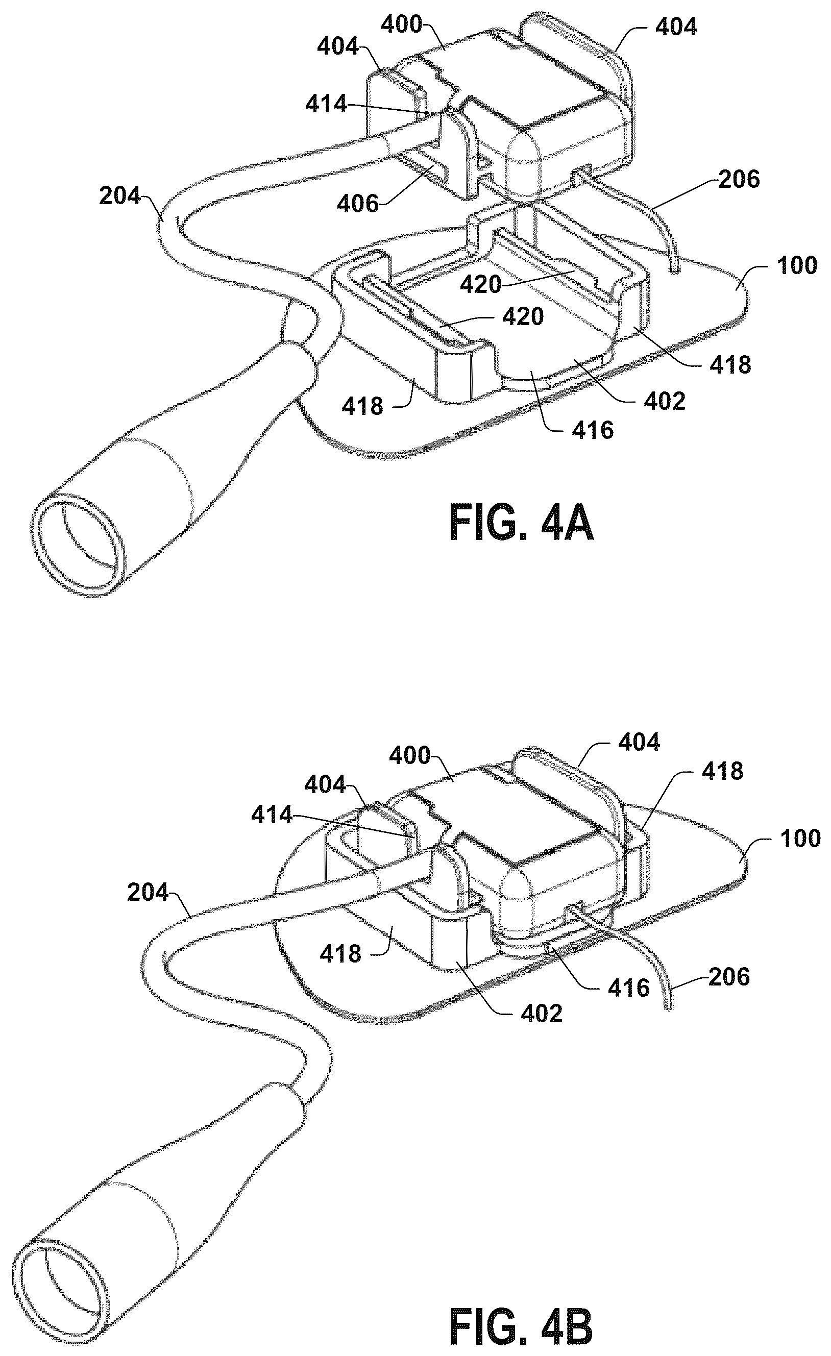 Patent US12551711 Figure 4 – Stimulation lead connection system