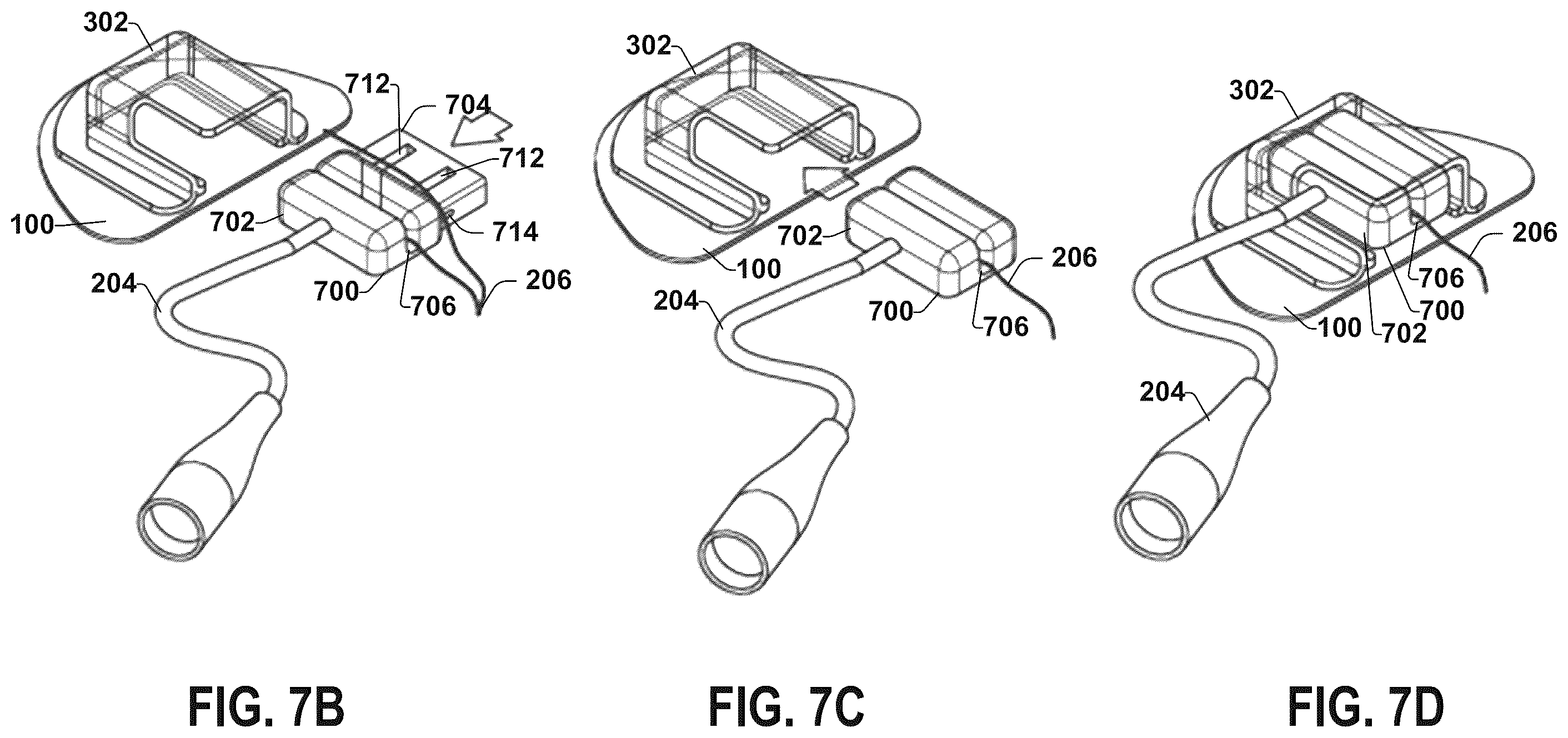 Patent US12551711 Figure 10 – Stimulation lead connection system