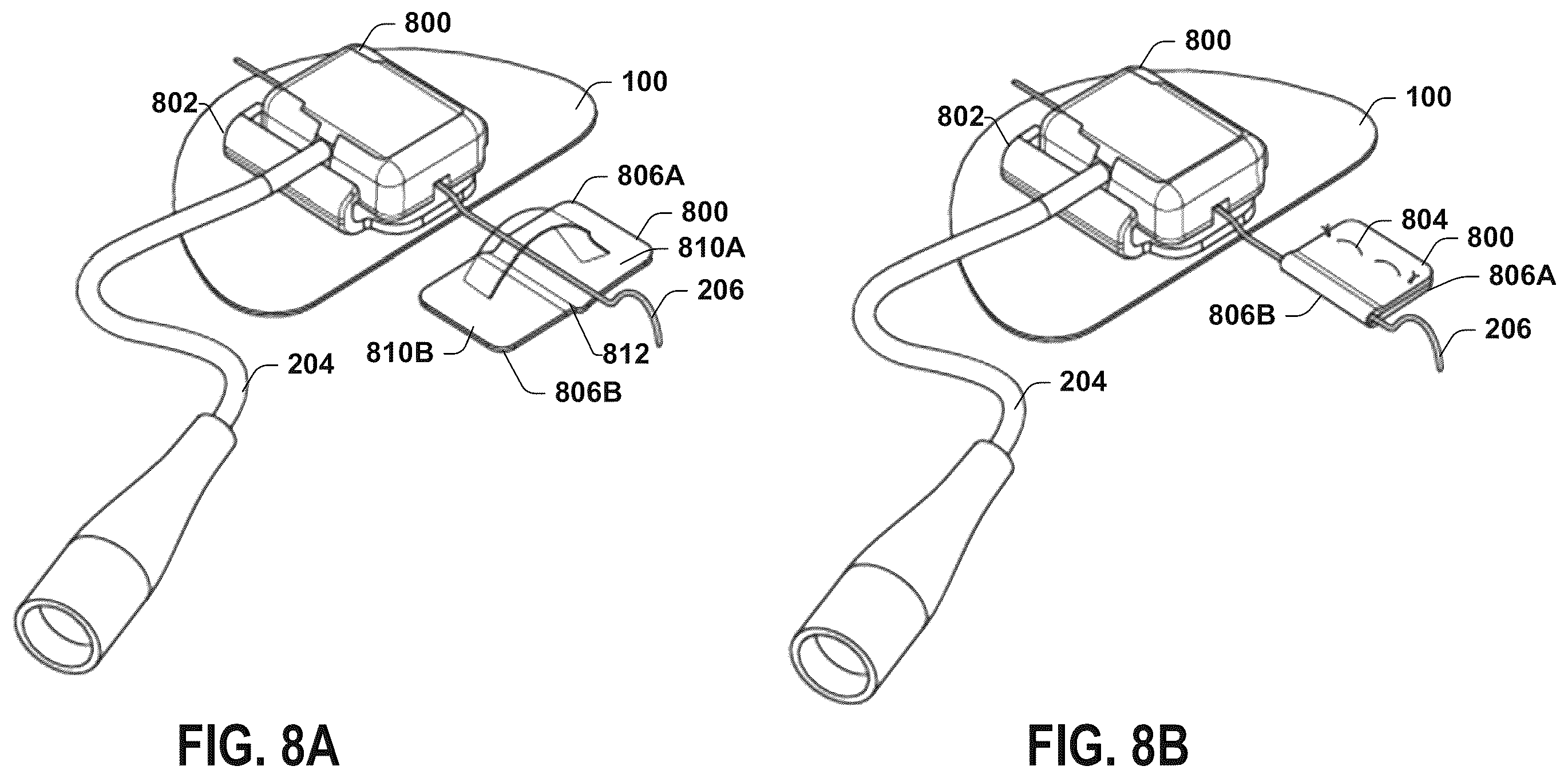 Patent US12551711 Figure 11 – Stimulation lead connection system