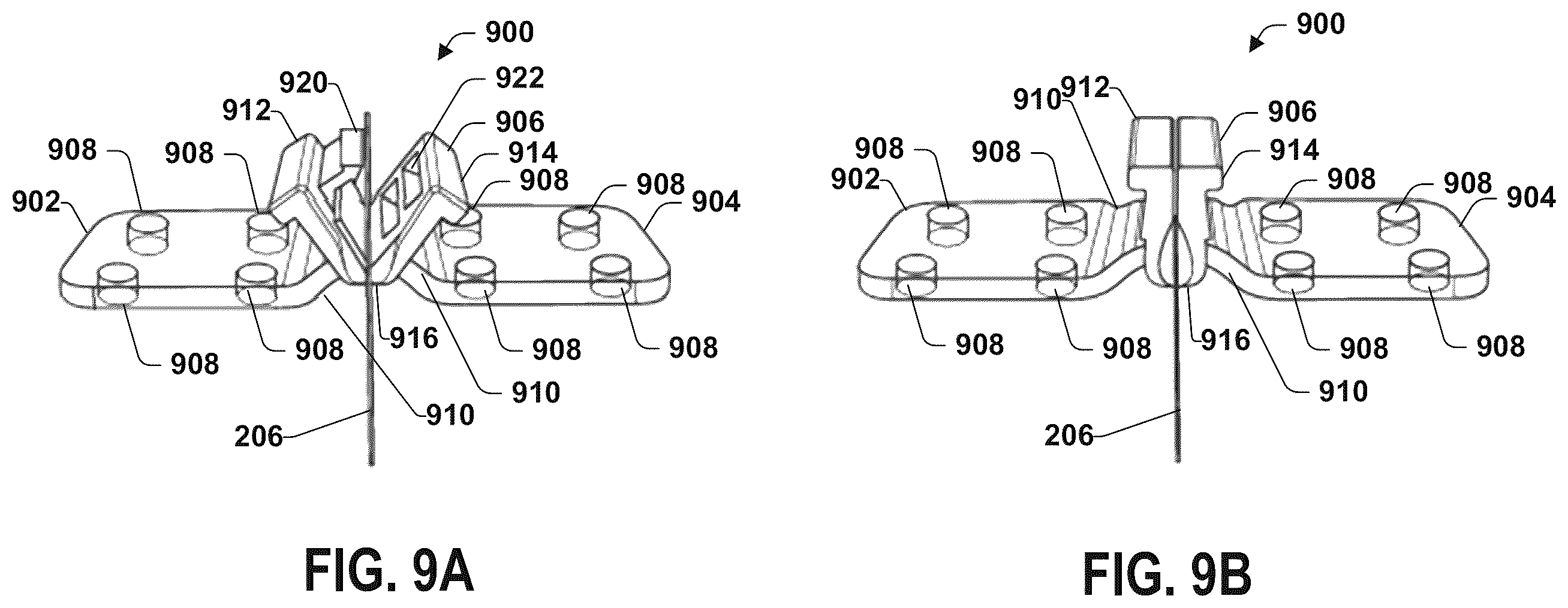 Patent US12551711 Figure 13 – Stimulation lead connection system