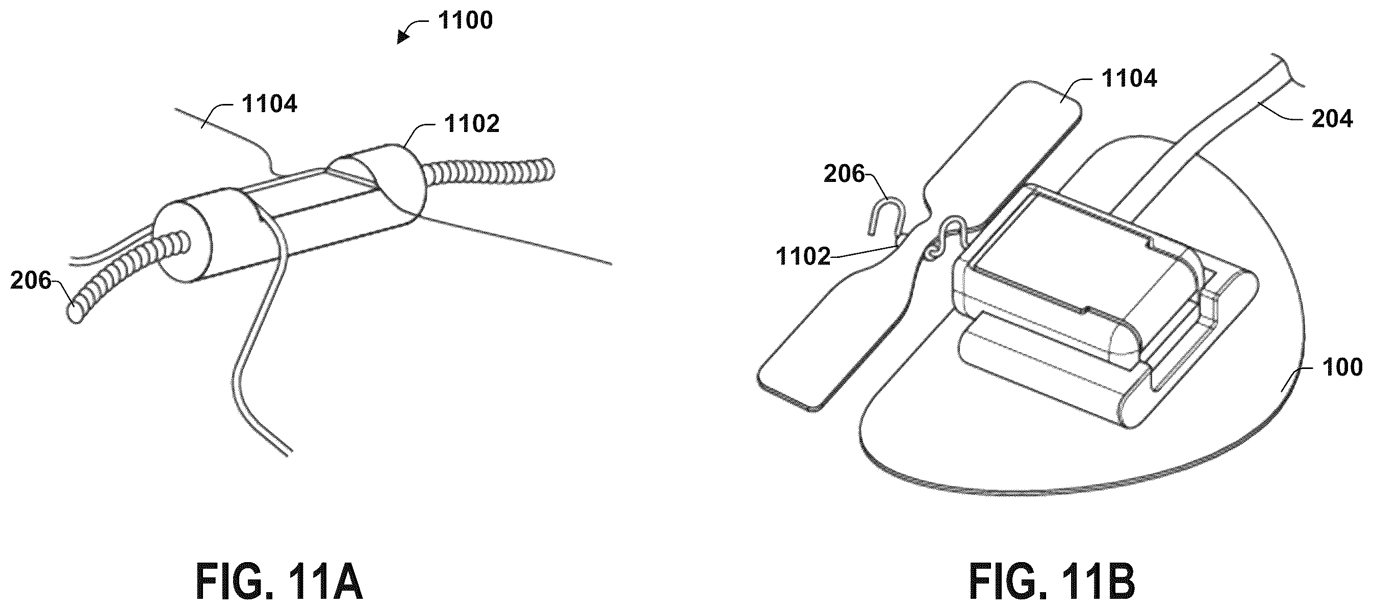 Patent US12551711 Figure 15 – Stimulation lead connection system