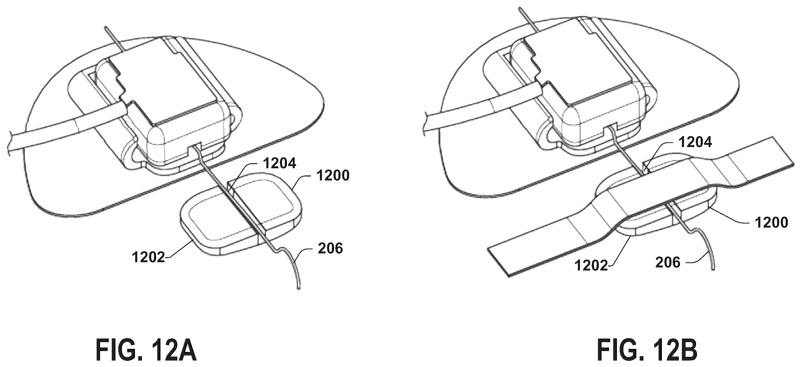 Patent US12551711 Figure 16 – Stimulation lead connection system