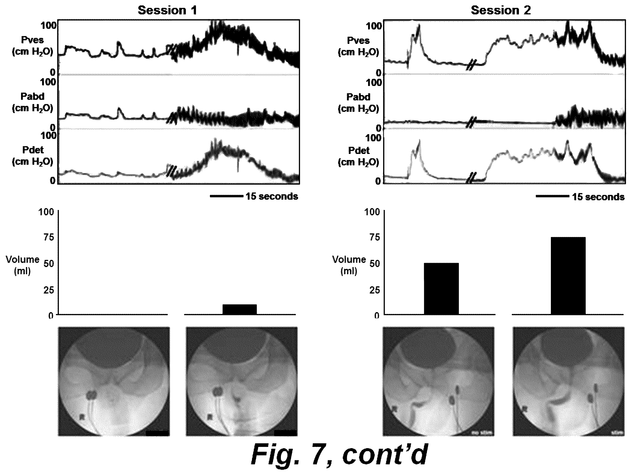 Patent US12551714 Figure 8 – Magnetic stimulation of the spinal cord to restore locomotor function and/or control of bladder and bowel