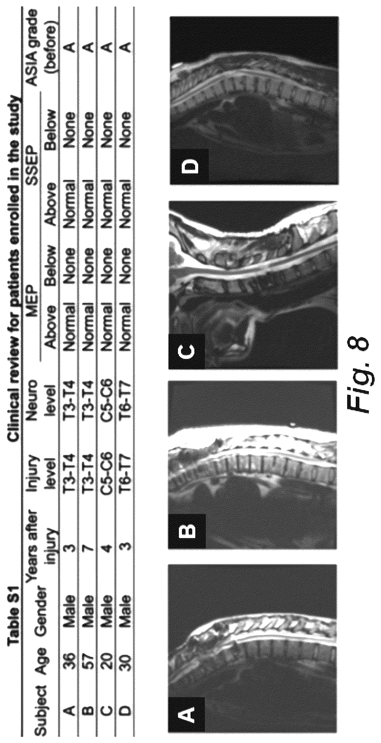 Patent US12551714 Figure 9 – Magnetic stimulation of the spinal cord to restore locomotor function and/or control of bladder and bowel
