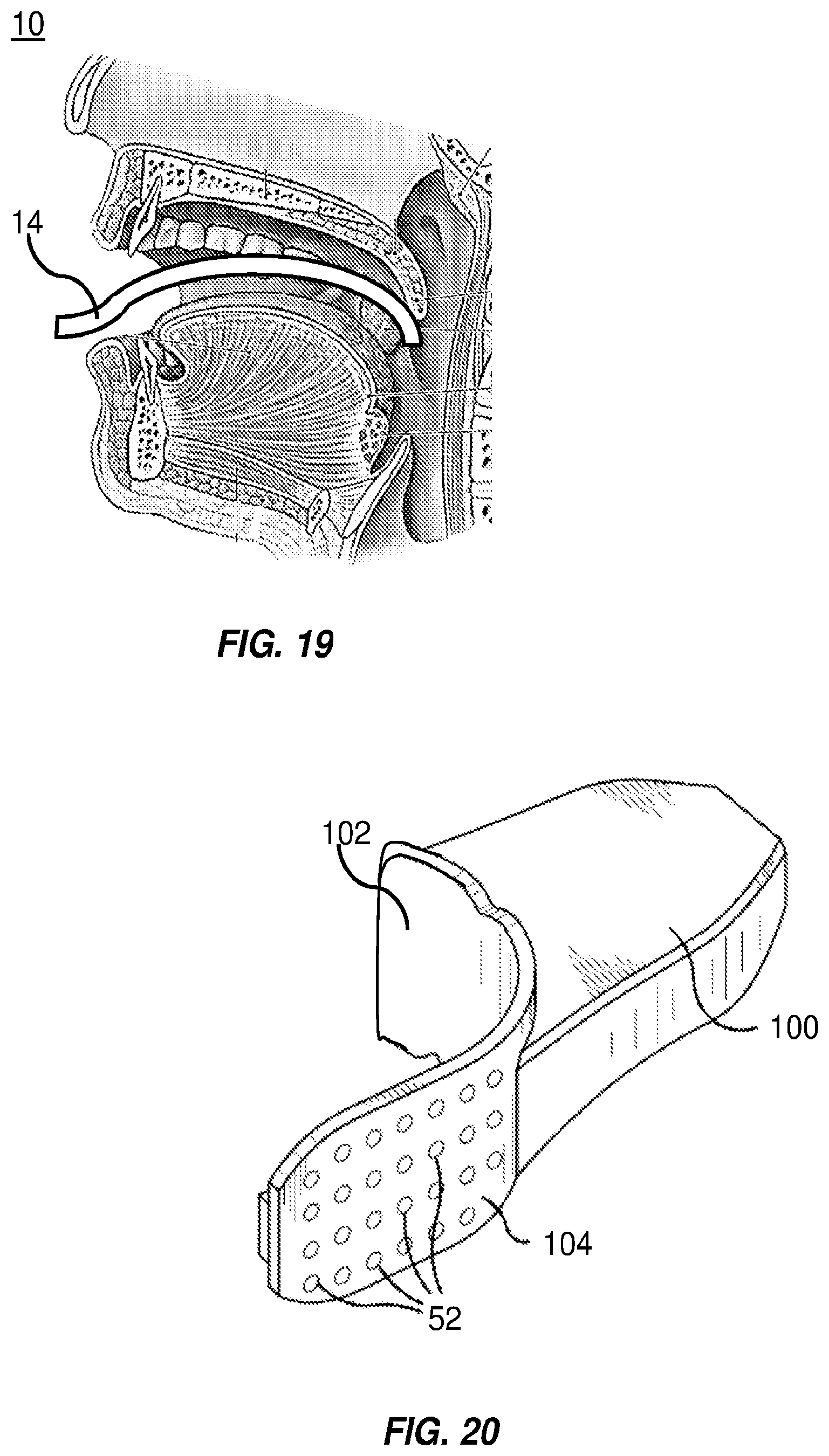 Patent US12551715 Figure 7 – Intraoral phototherapy probe
