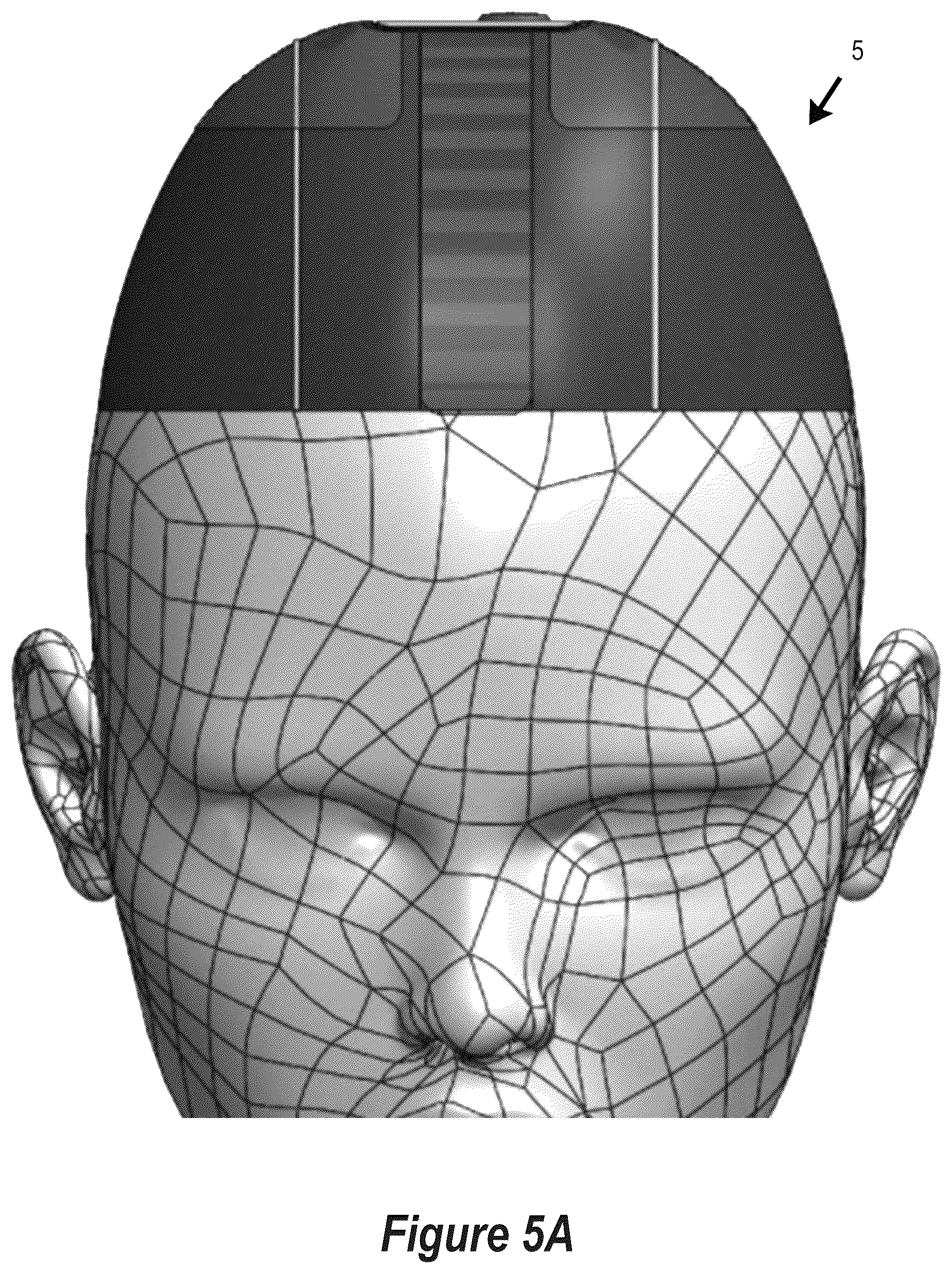 Patent US12551716 Figure 13 – Phototherapy devices for treatment of dermatological disorders of the scalp