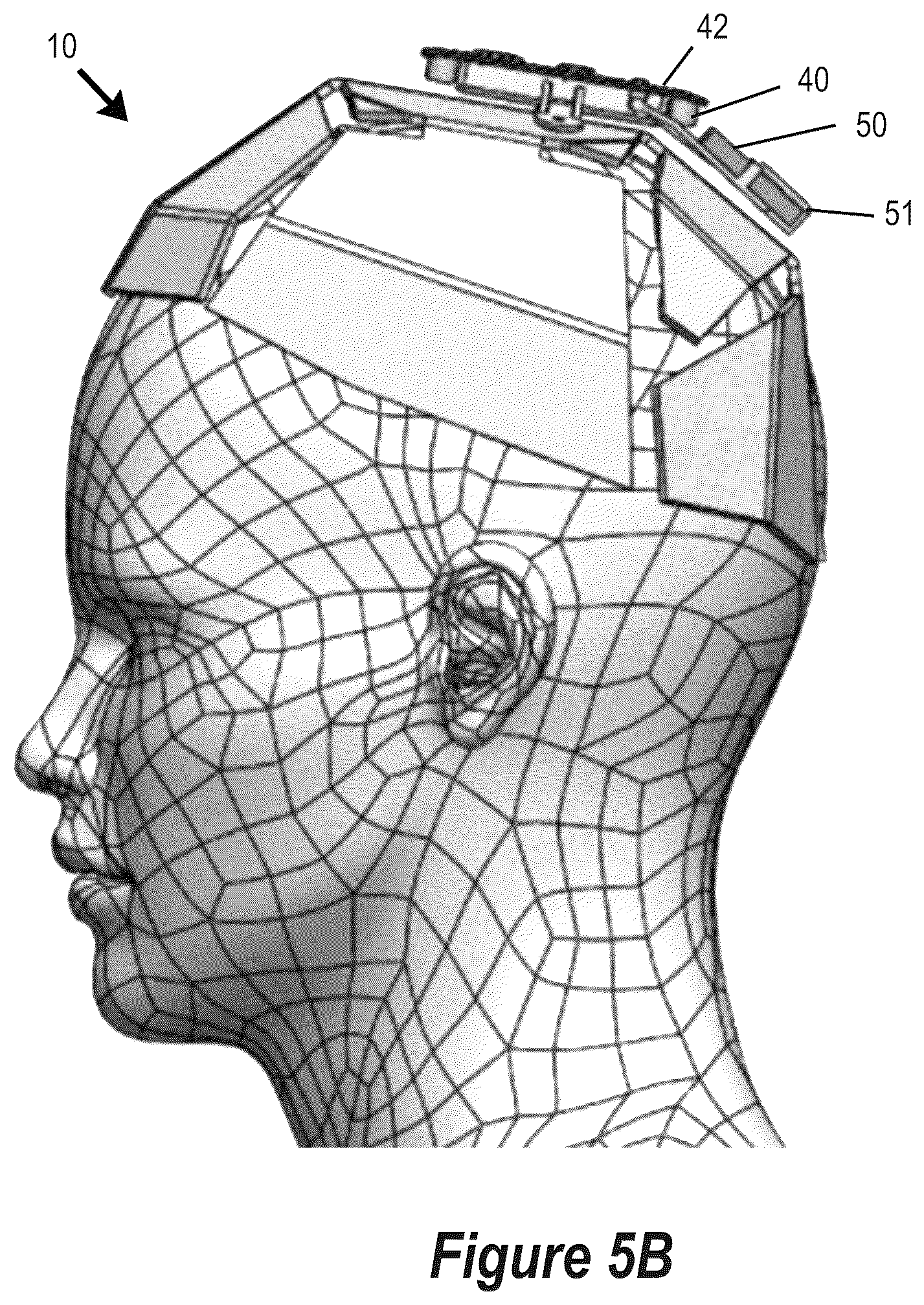 Patent US12551716 Figure 14 – Phototherapy devices for treatment of dermatological disorders of the scalp