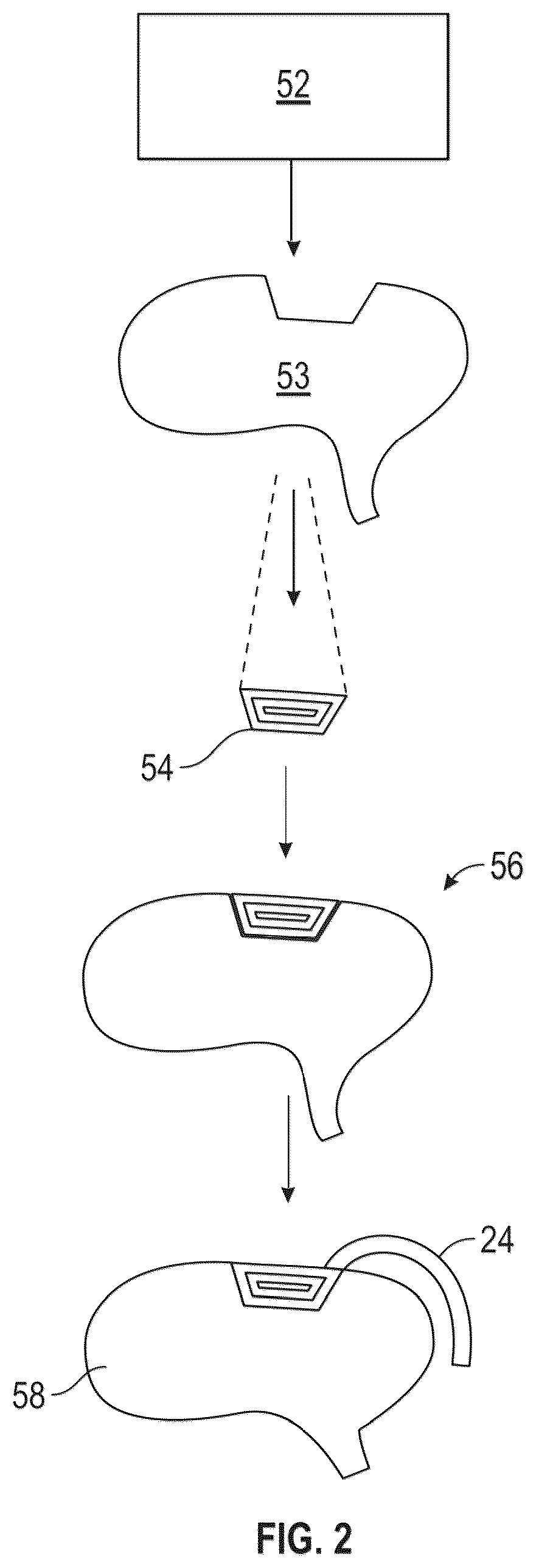 Patent US12551719 Figure 2 – Pulsating brachytherapy method and system