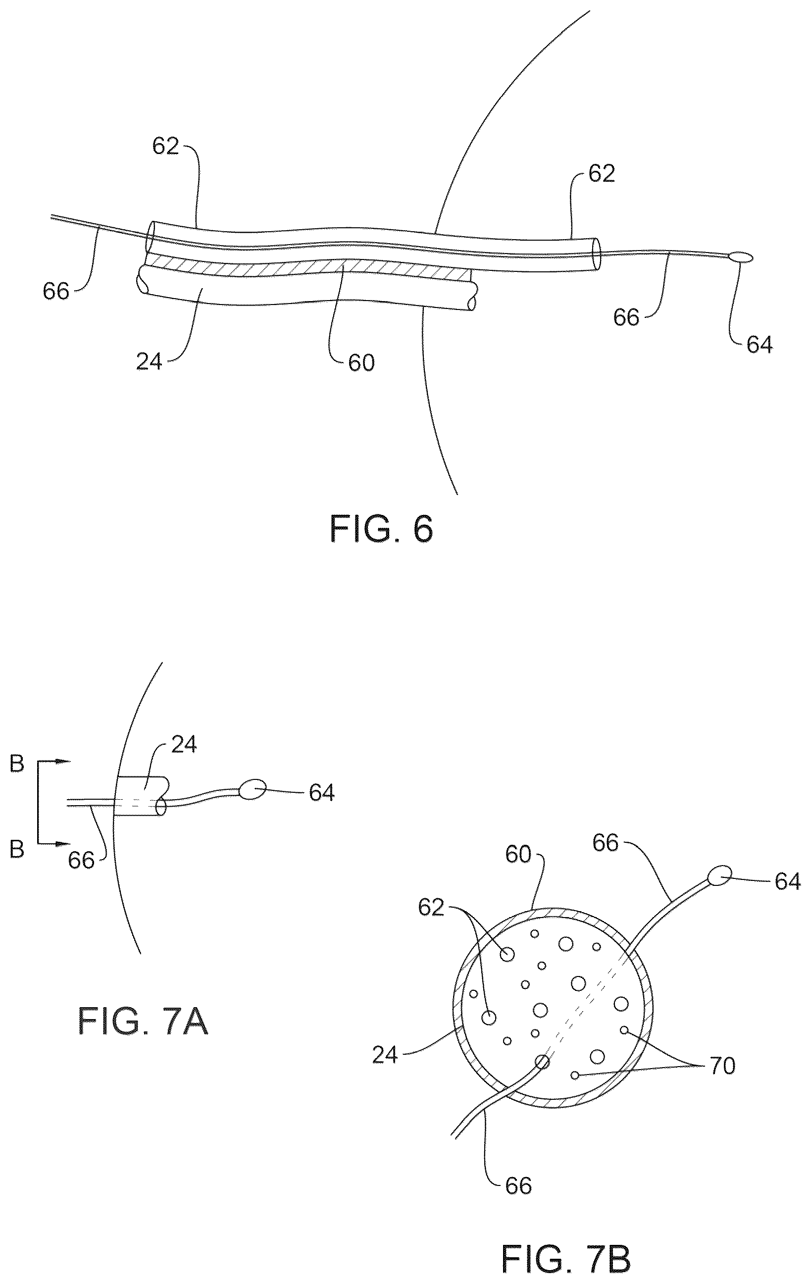 Patent US12551719 Figure 7 – Pulsating brachytherapy method and system