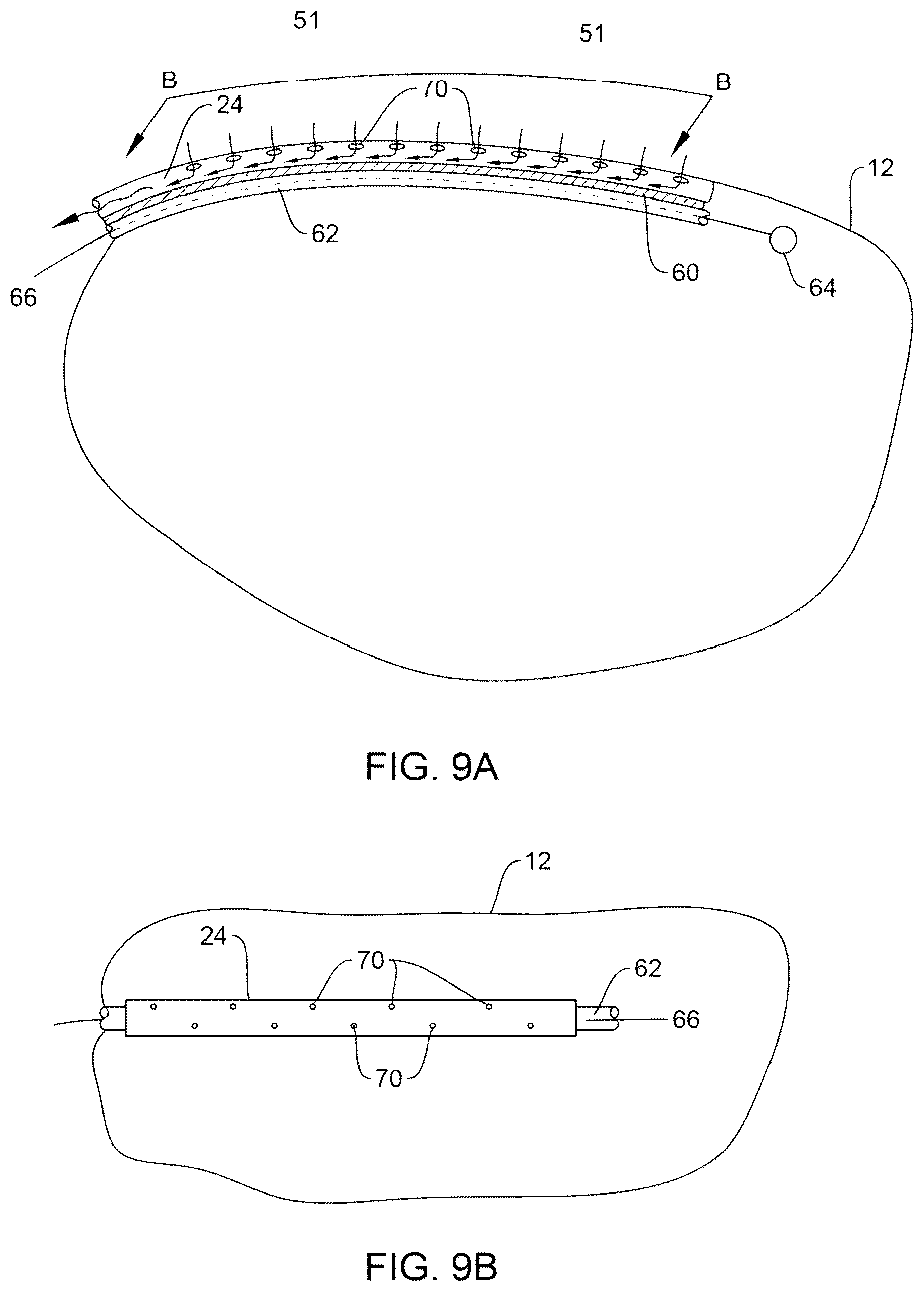 Patent US12551719 Figure 9 – Pulsating brachytherapy method and system