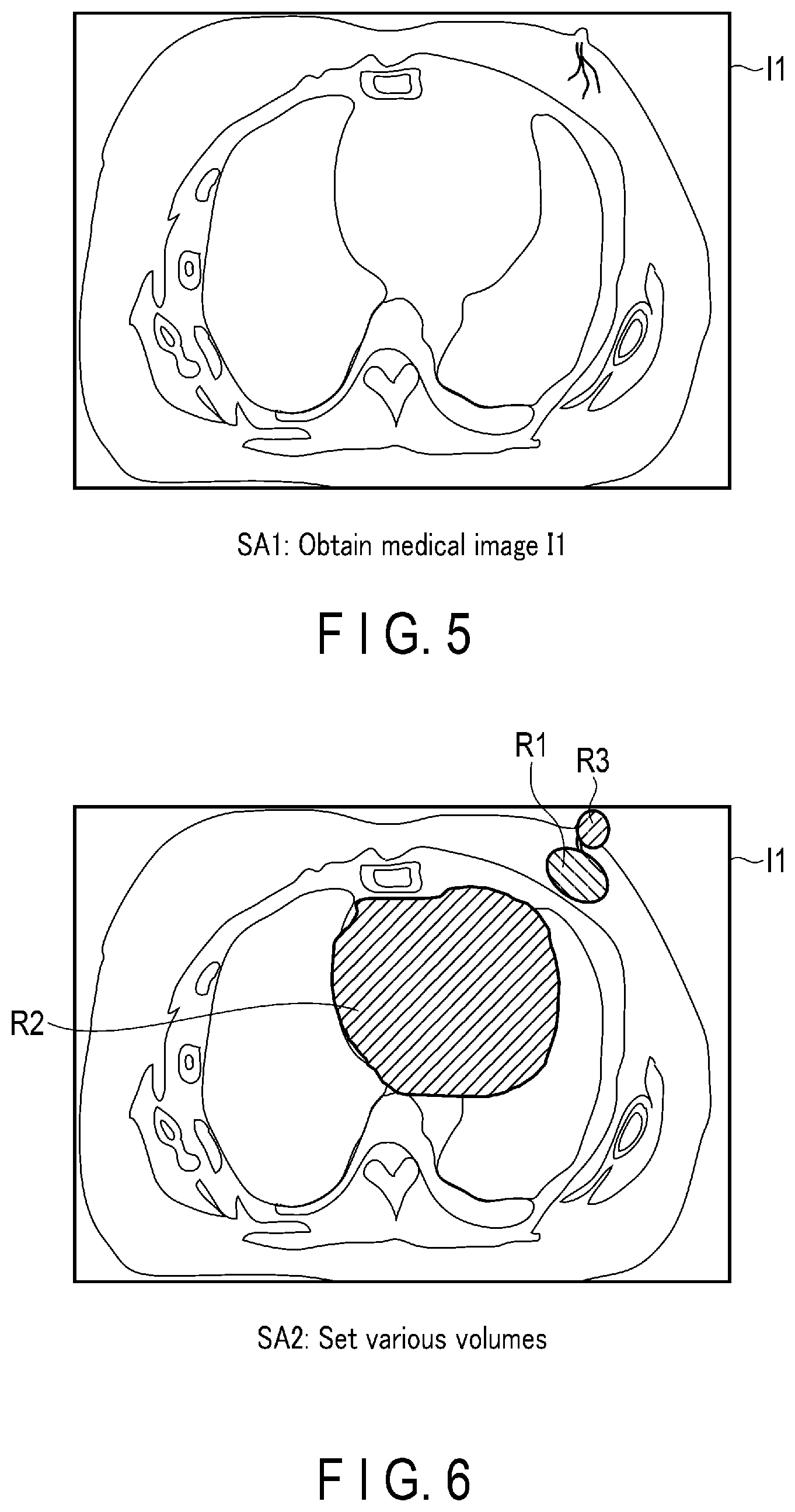 Patent US12551721 Figure 4 – Radiotherapy planning apparatus and radiotherapy system