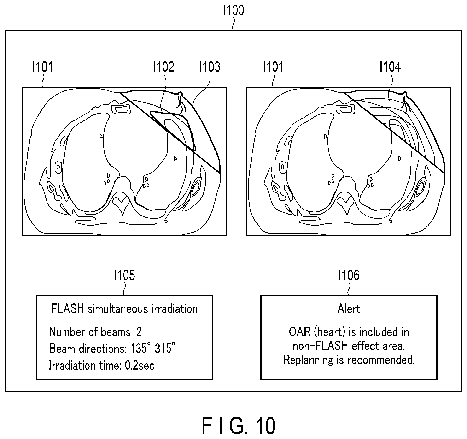 Patent US12551721 Figure 7 – Radiotherapy planning apparatus and radiotherapy system
