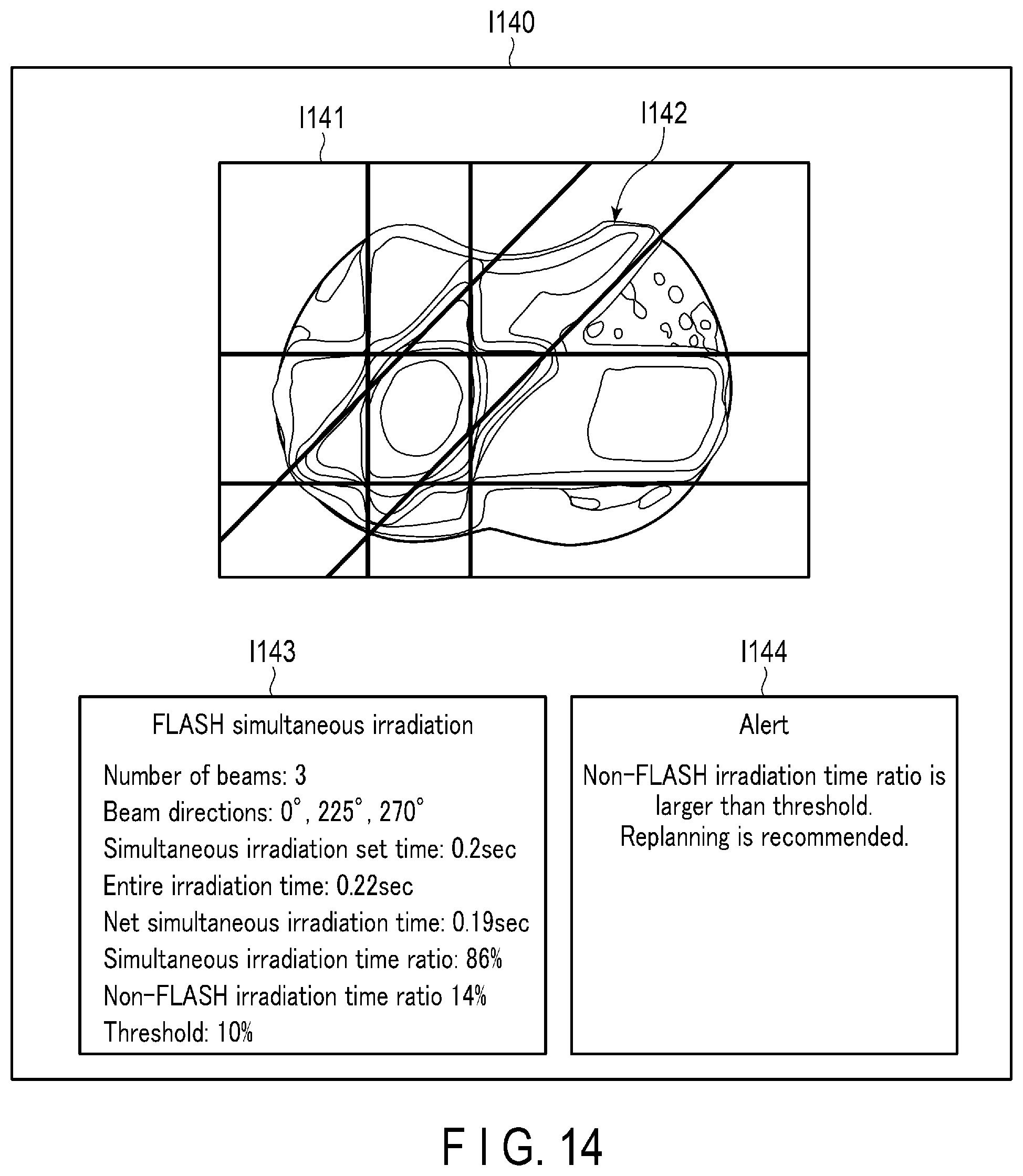 Patent US12551721 Figure 11 – Radiotherapy planning apparatus and radiotherapy system