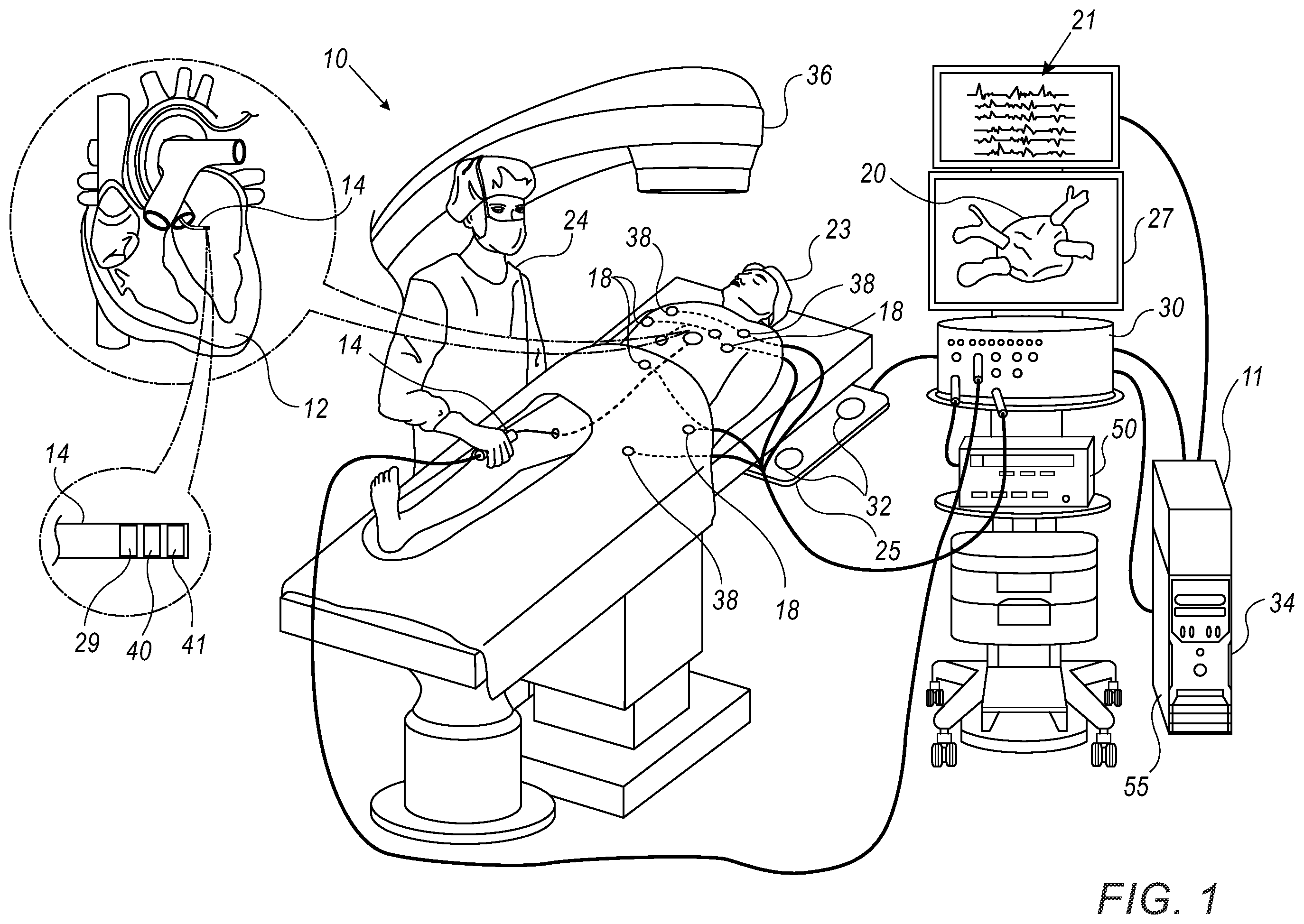 Patent US12551724 Figure 1 – Facilitating ablative radiotherapy using an intrabody catheter