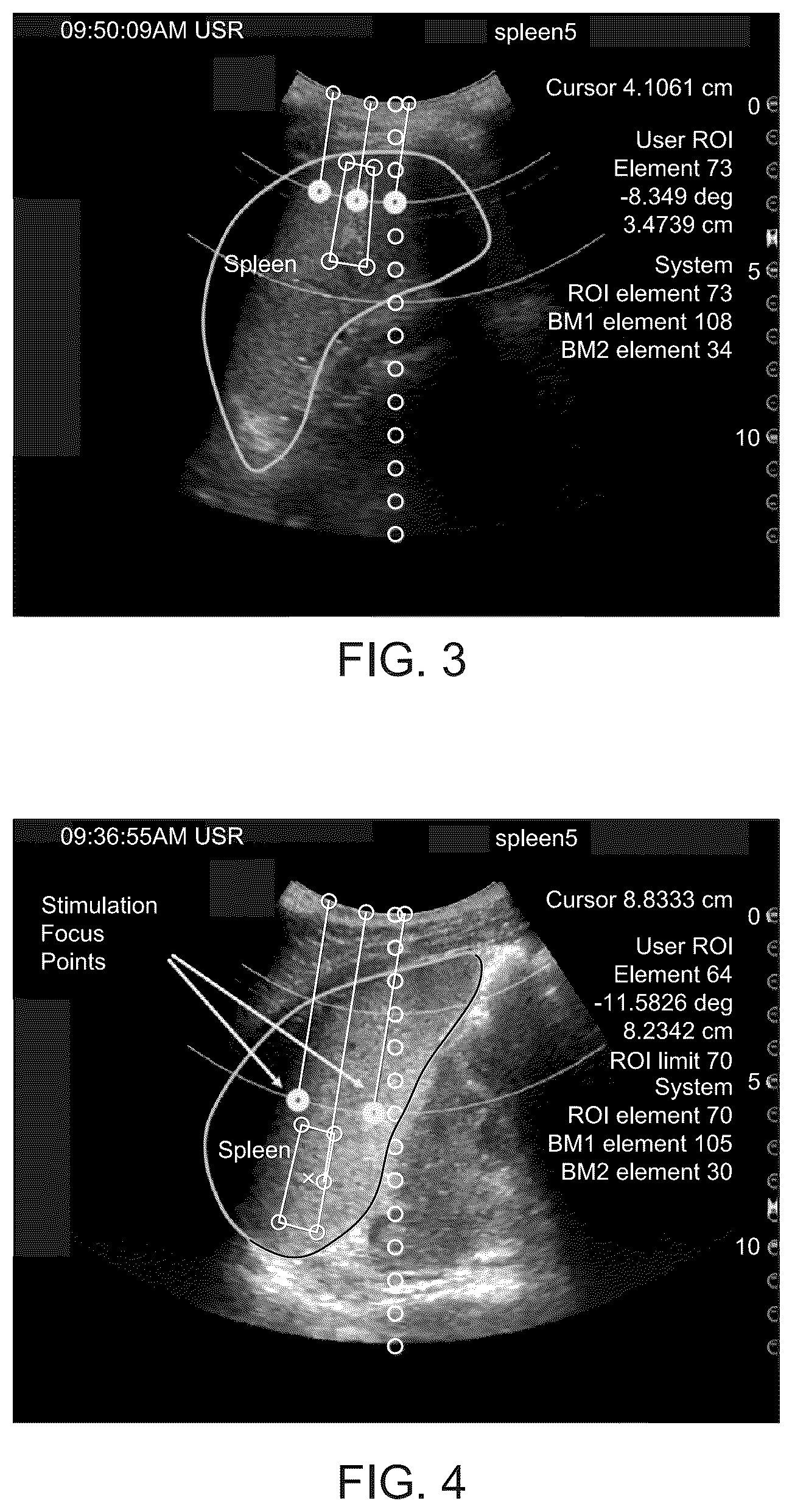 Patent US12551729 Figure 3 – Multi-beam neuromodulation techniques