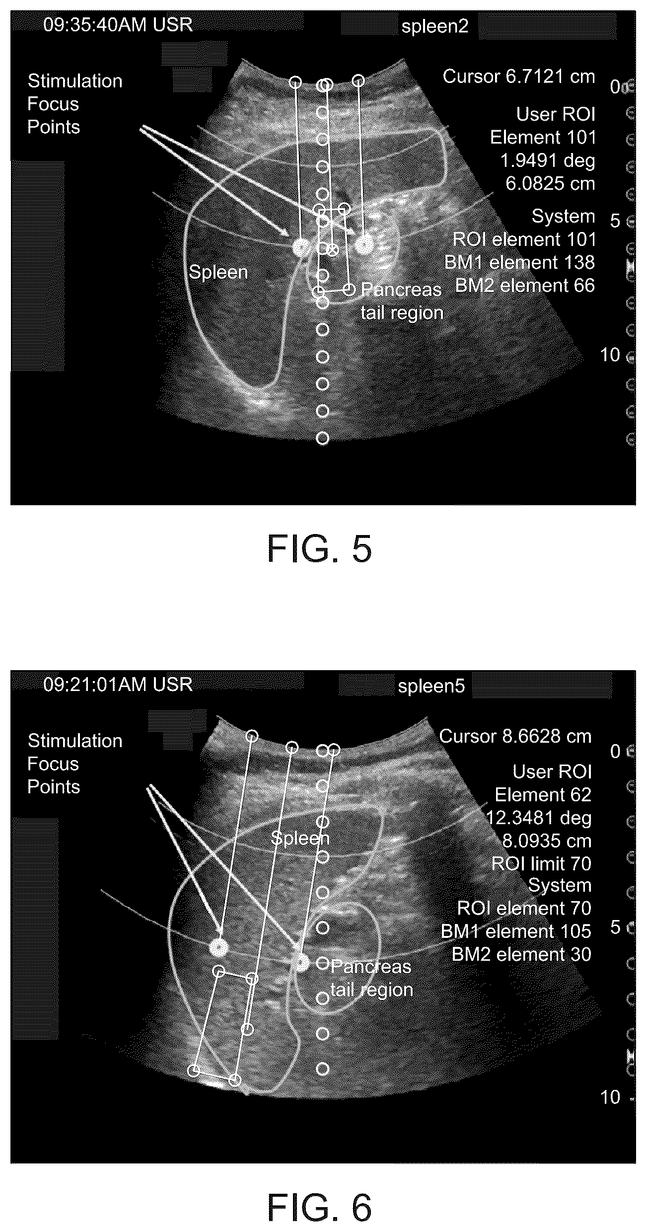 Patent US12551729 Figure 4 – Multi-beam neuromodulation techniques