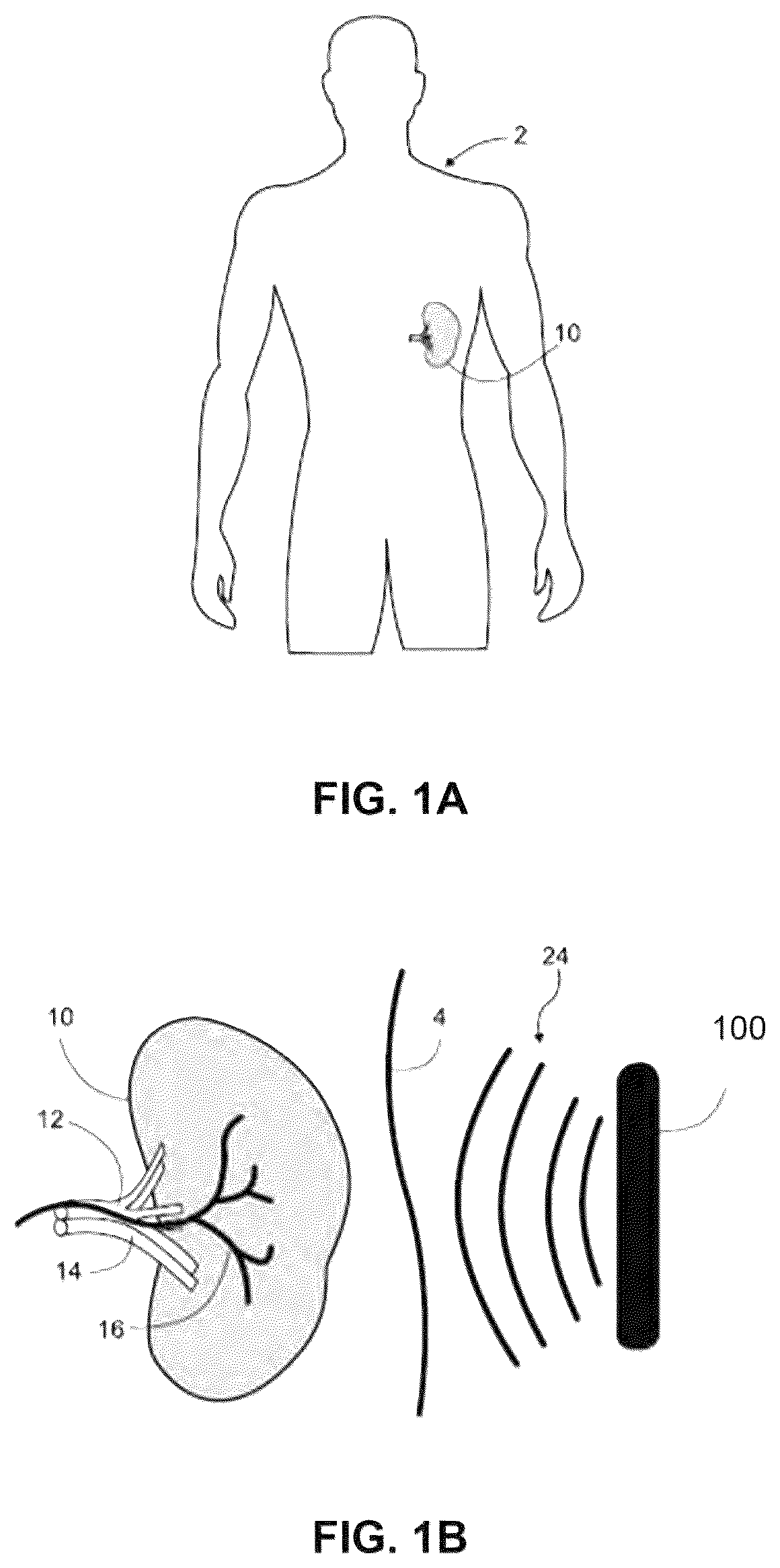 Patent US12551730 Figure 1 – Systems and methods for ultrasound neuromodulation of desired anatomical targets