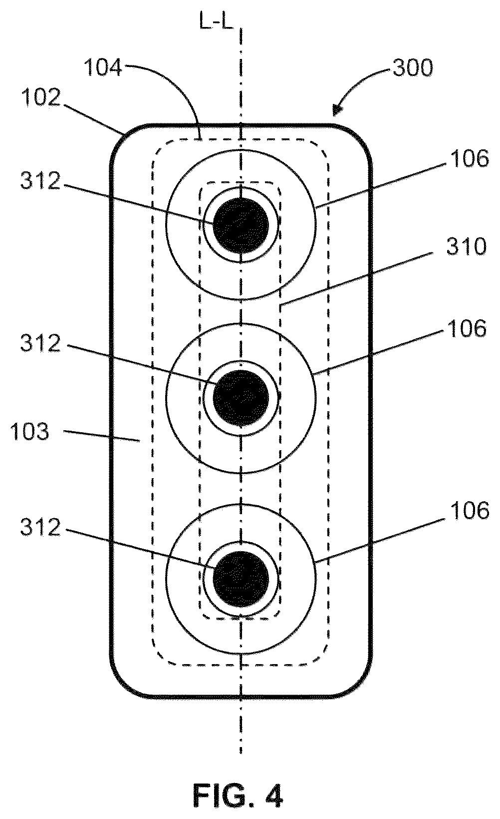 Patent US12551730 Figure 4 – Systems and methods for ultrasound neuromodulation of desired anatomical targets