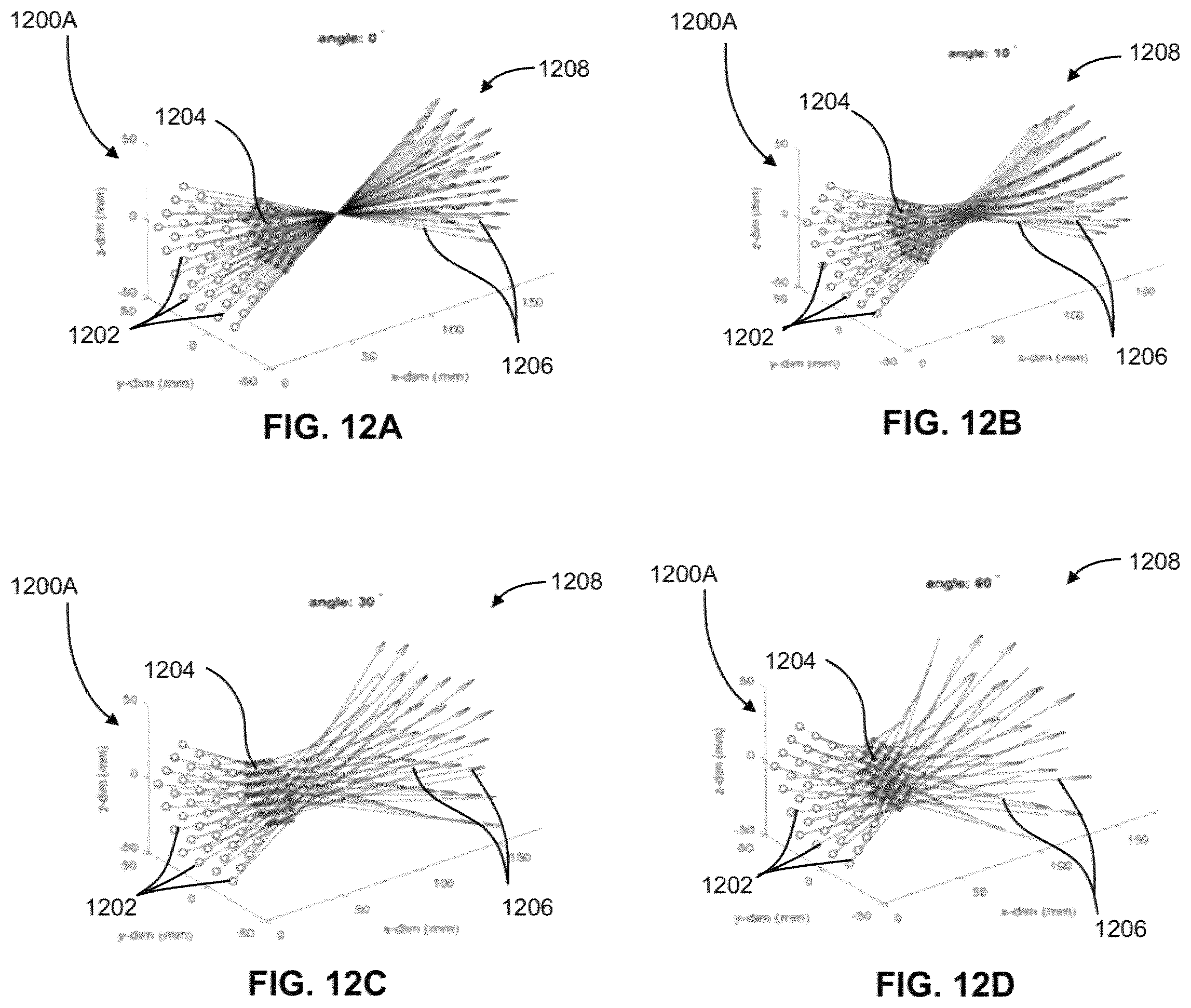 Patent US12551730 Figure 12 – Systems and methods for ultrasound neuromodulation of desired anatomical targets