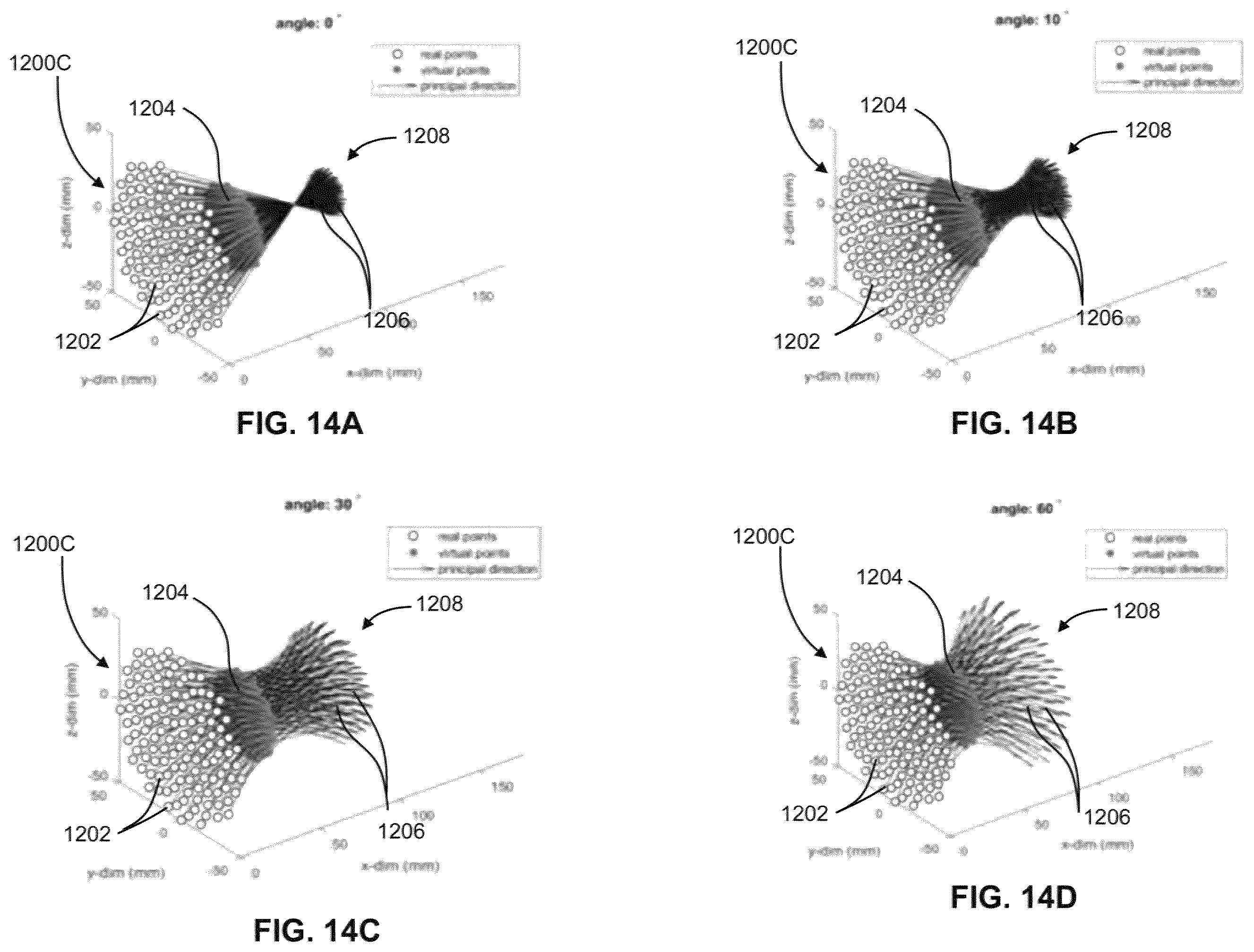 Patent US12551730 Figure 14 – Systems and methods for ultrasound neuromodulation of desired anatomical targets