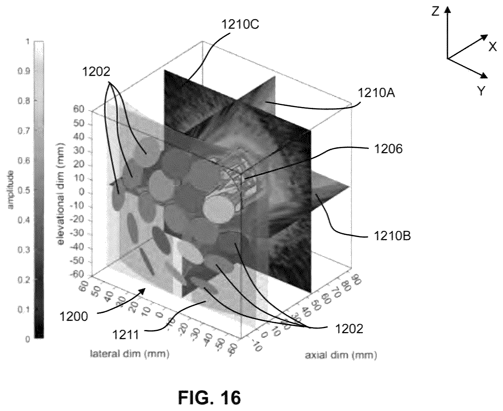 Patent US12551730 Figure 16 – Systems and methods for ultrasound neuromodulation of desired anatomical targets