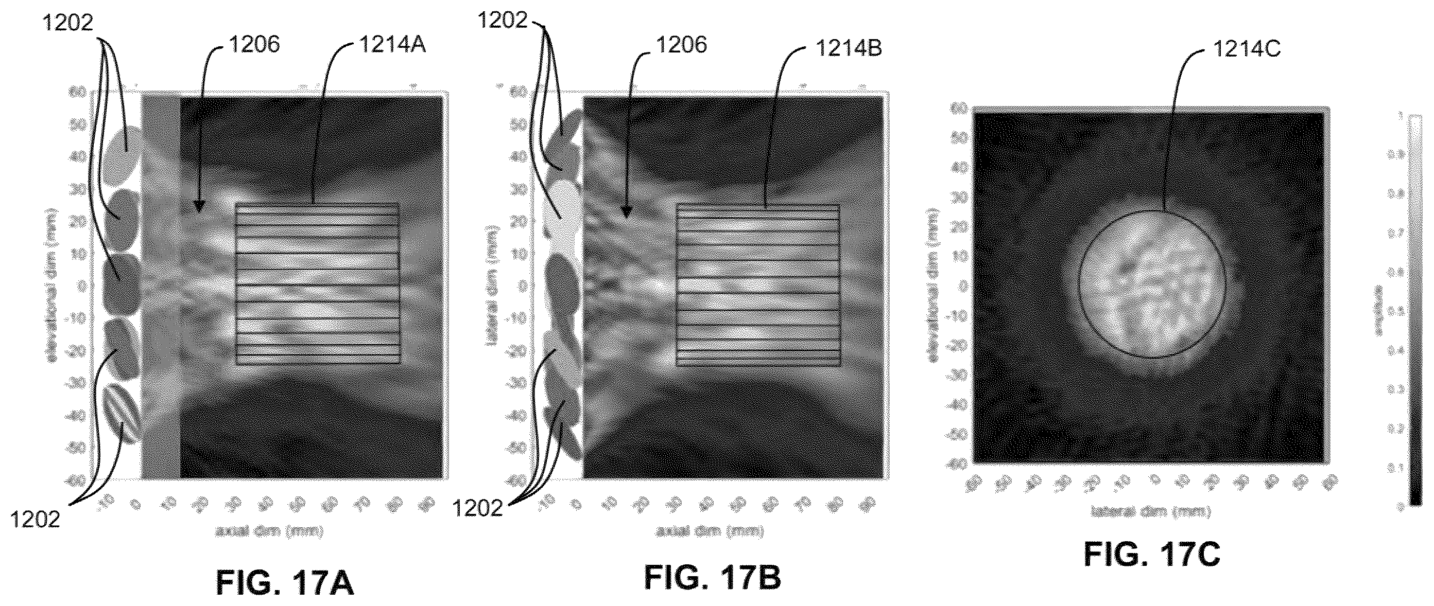 Patent US12551730 Figure 17 – Systems and methods for ultrasound neuromodulation of desired anatomical targets