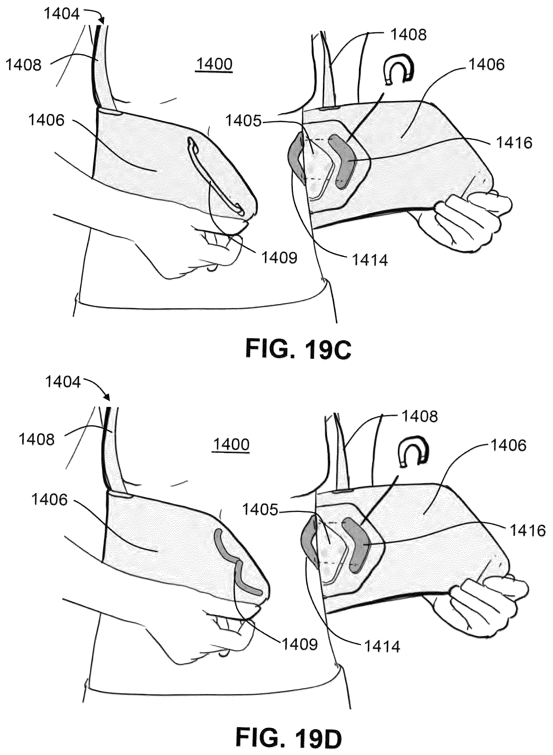 Patent US12551730 Figure 20 – Systems and methods for ultrasound neuromodulation of desired anatomical targets