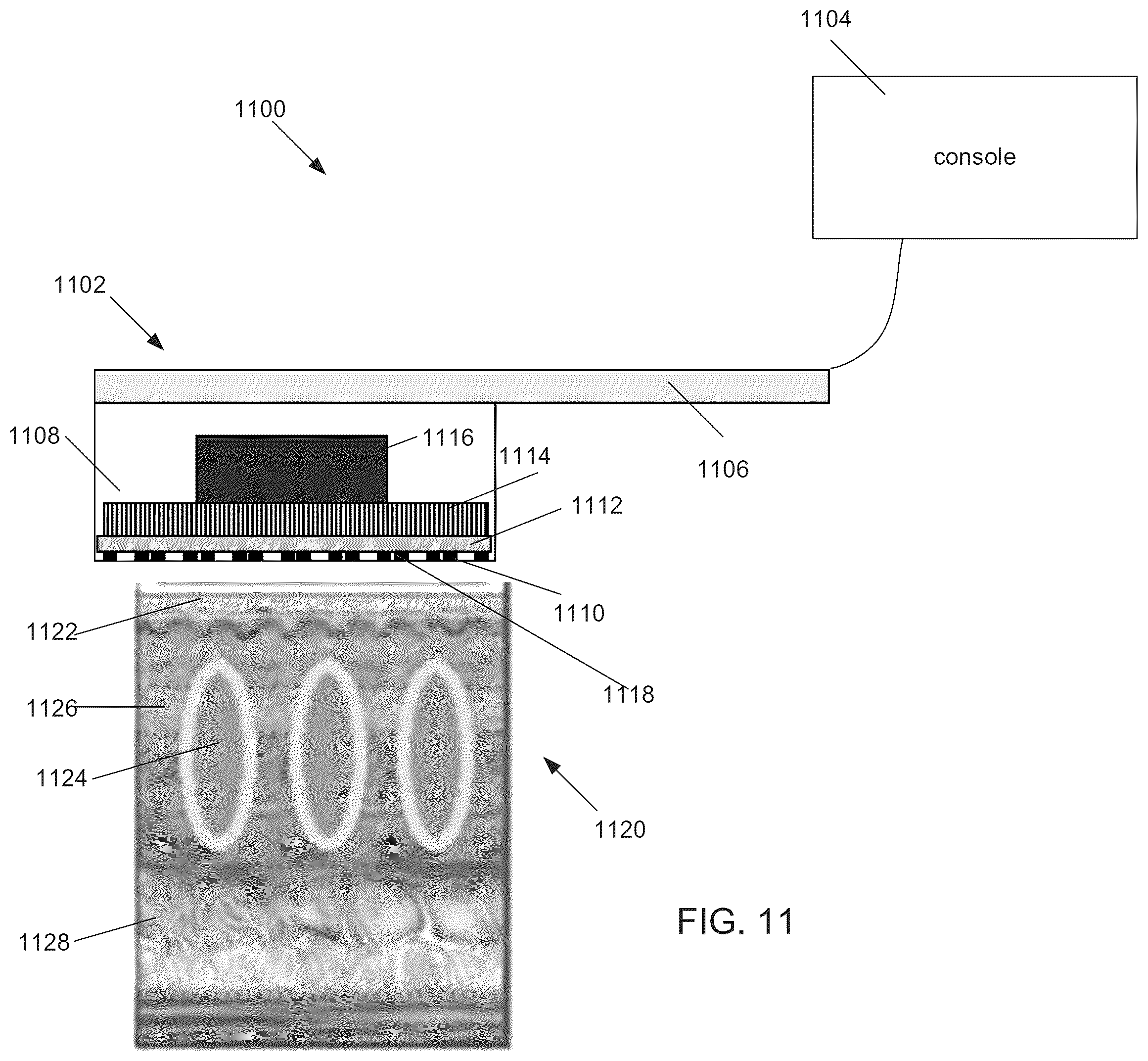 Patent US12551731 Figure 12 – Ultrasound transducer and system