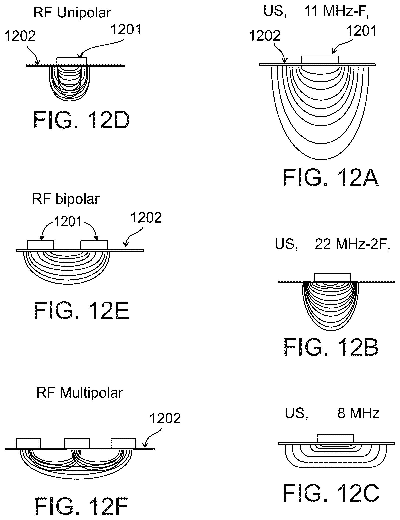 Patent US12551731 Figure 13 – Ultrasound transducer and system