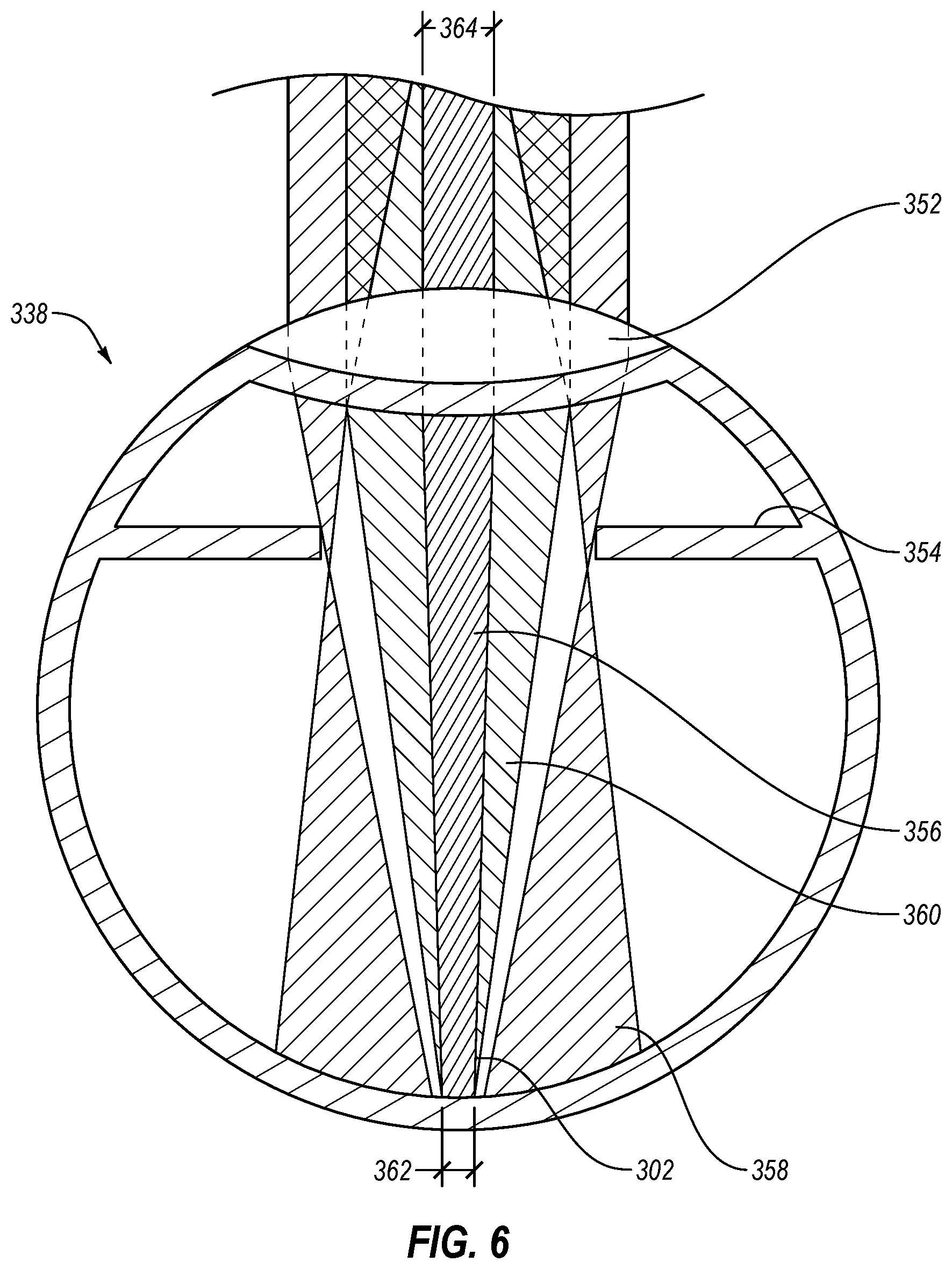 Patent US12551732 Figure 6 – Method and apparatus for removing microvessels