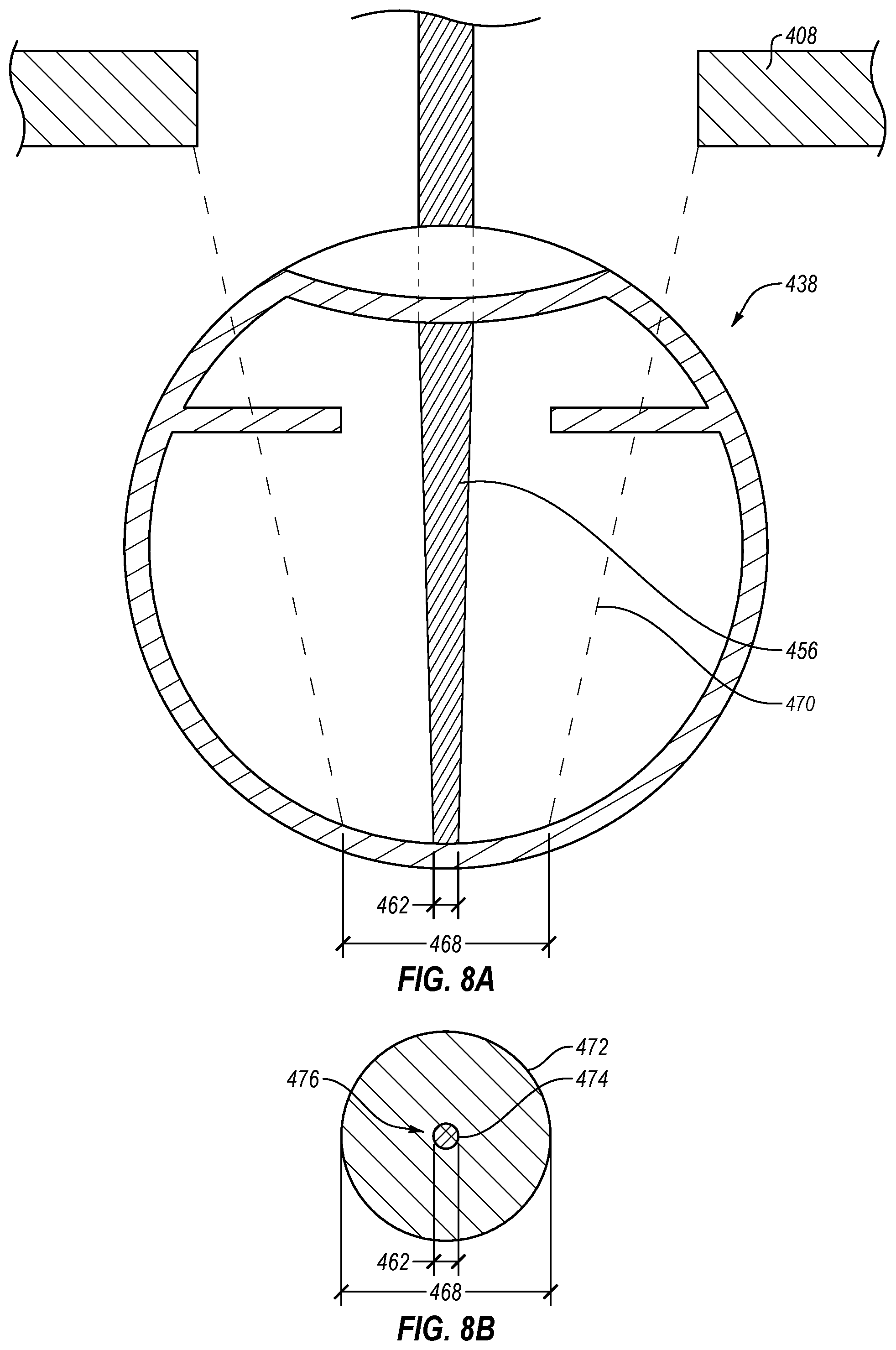 Patent US12551732 Figure 8 – Method and apparatus for removing microvessels