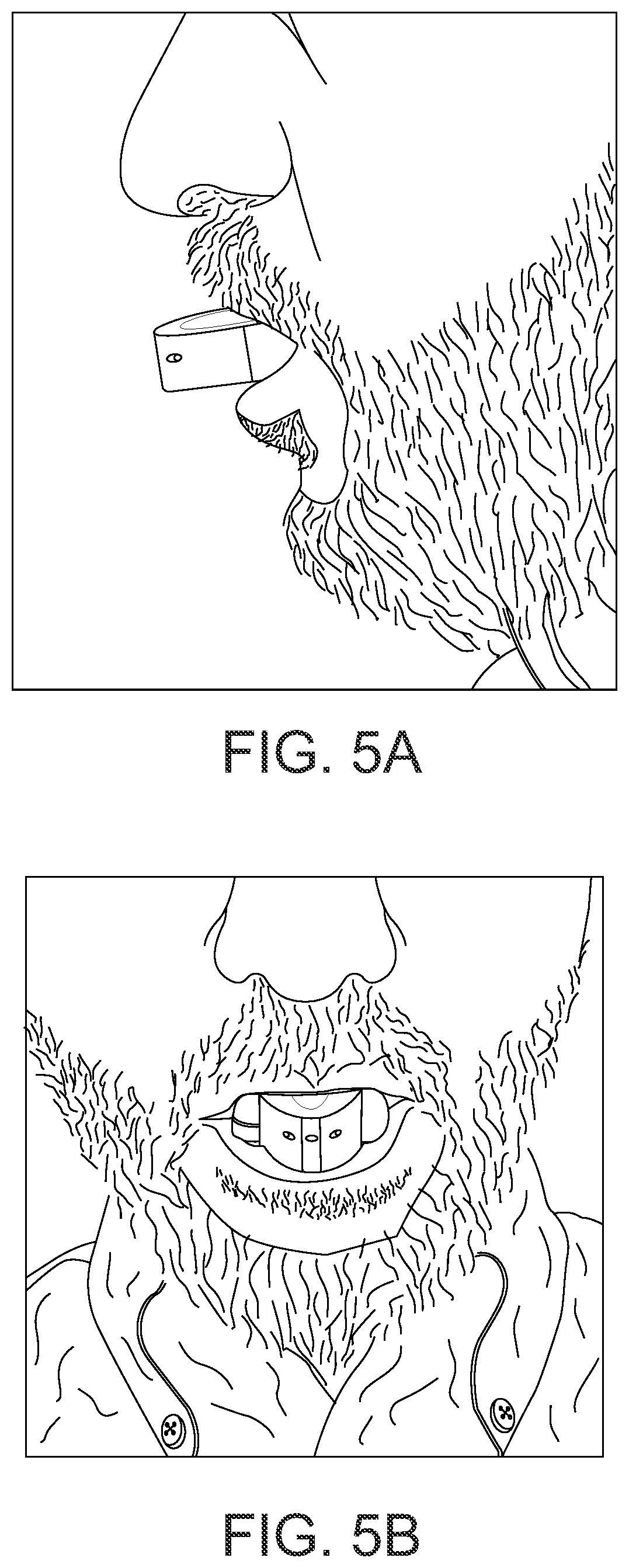 Patent US12551754 Figure 5 – Portable oral positive expiratory pressure-generating devices with variable expiratory airflow resistances