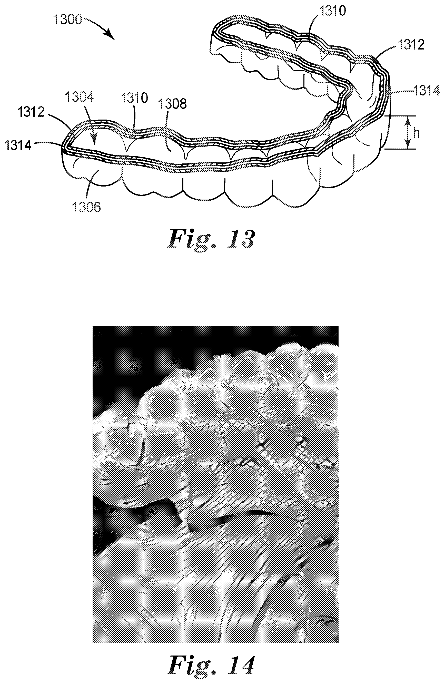 Patent US12552087 Figure 8 – Method of thermoforming film with structured surface and articles