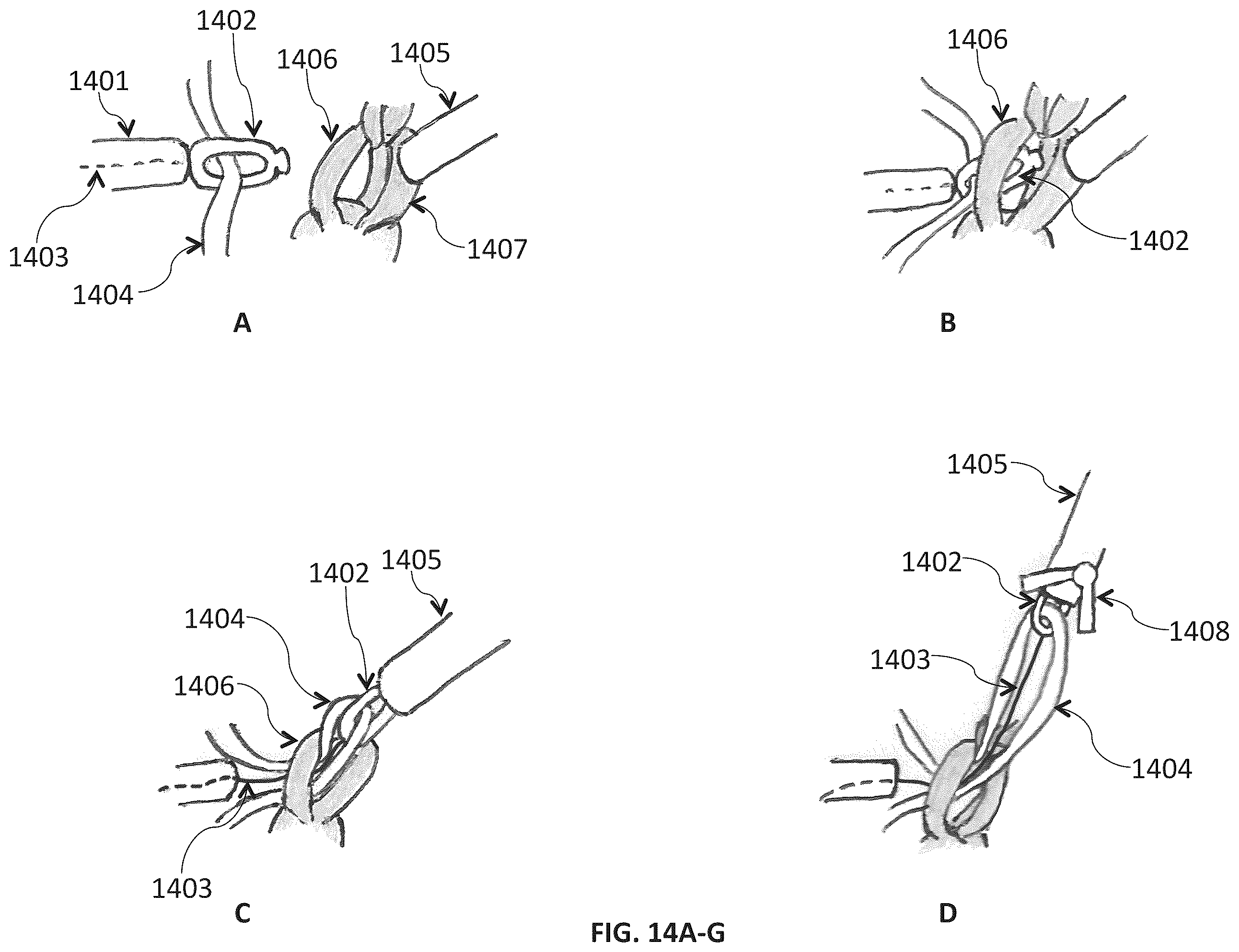 Patent US12552091 Figure 17 – Additive manufacturing system using interlinked repeating subunits
