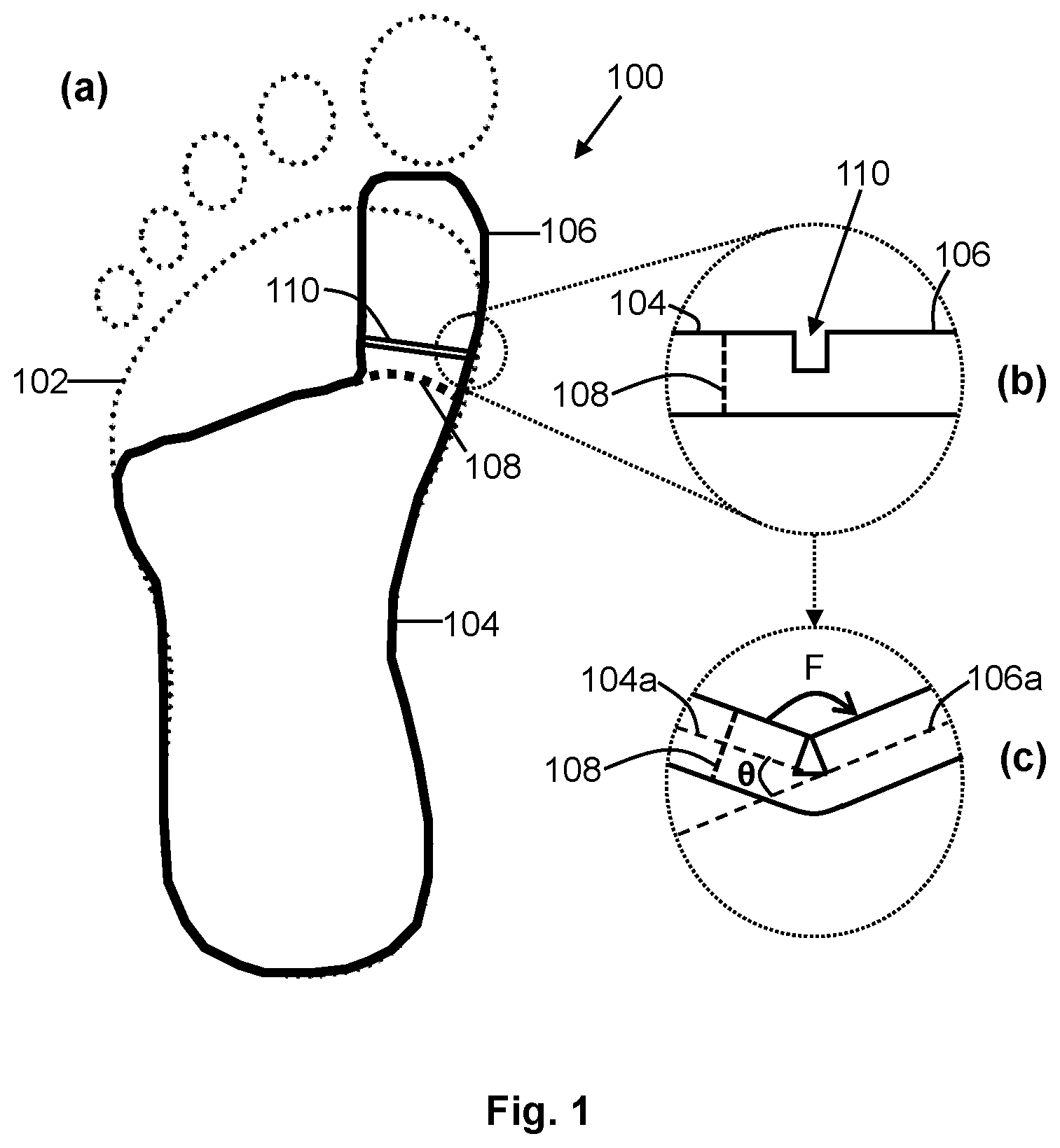 Patent US12552120 Figure 1 – Personalizing foot supports