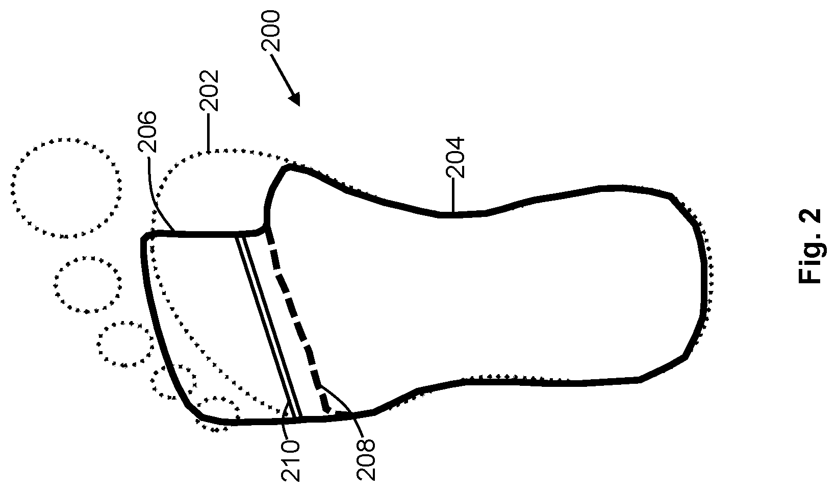 Patent US12552120 Figure 2 – Personalizing foot supports