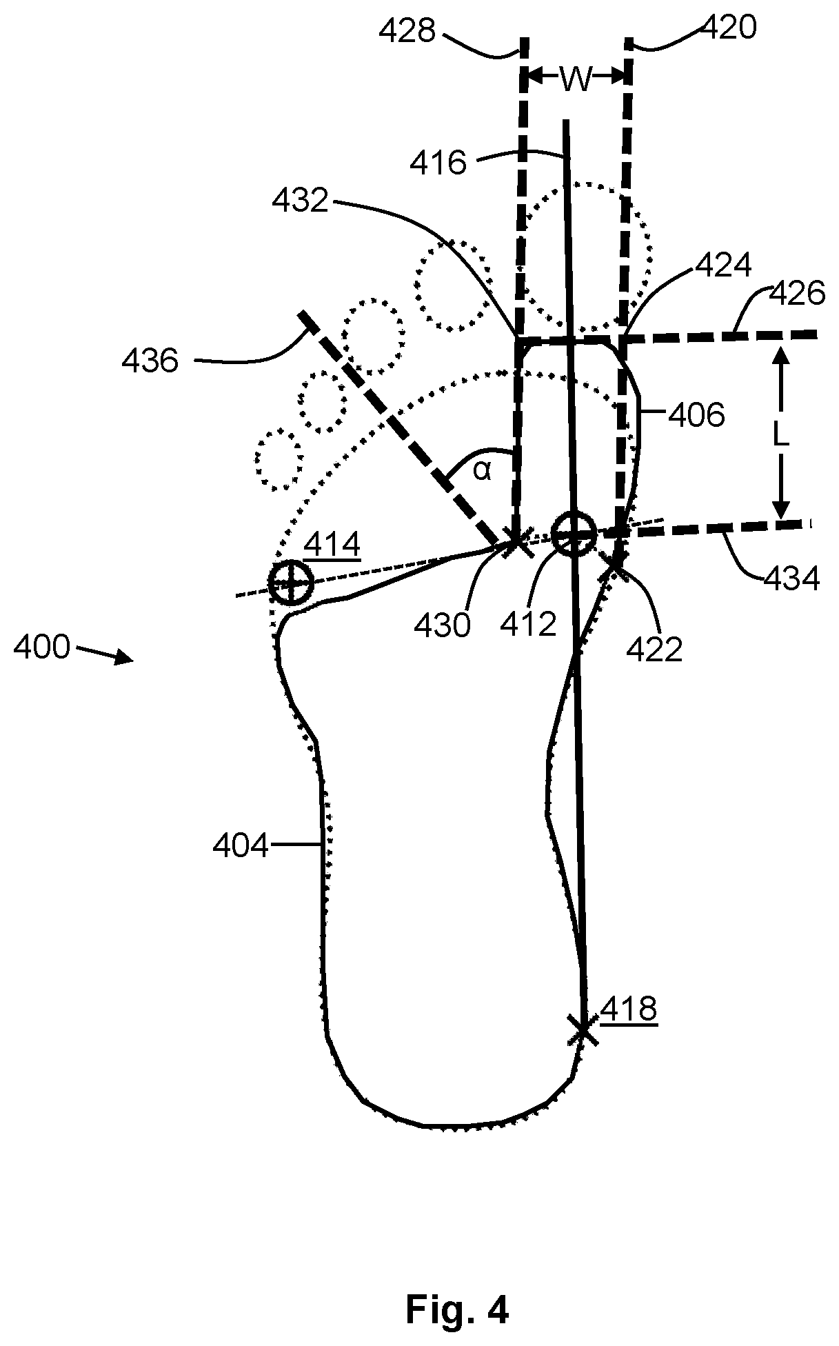 Patent US12552120 Figure 4 – Personalizing foot supports
