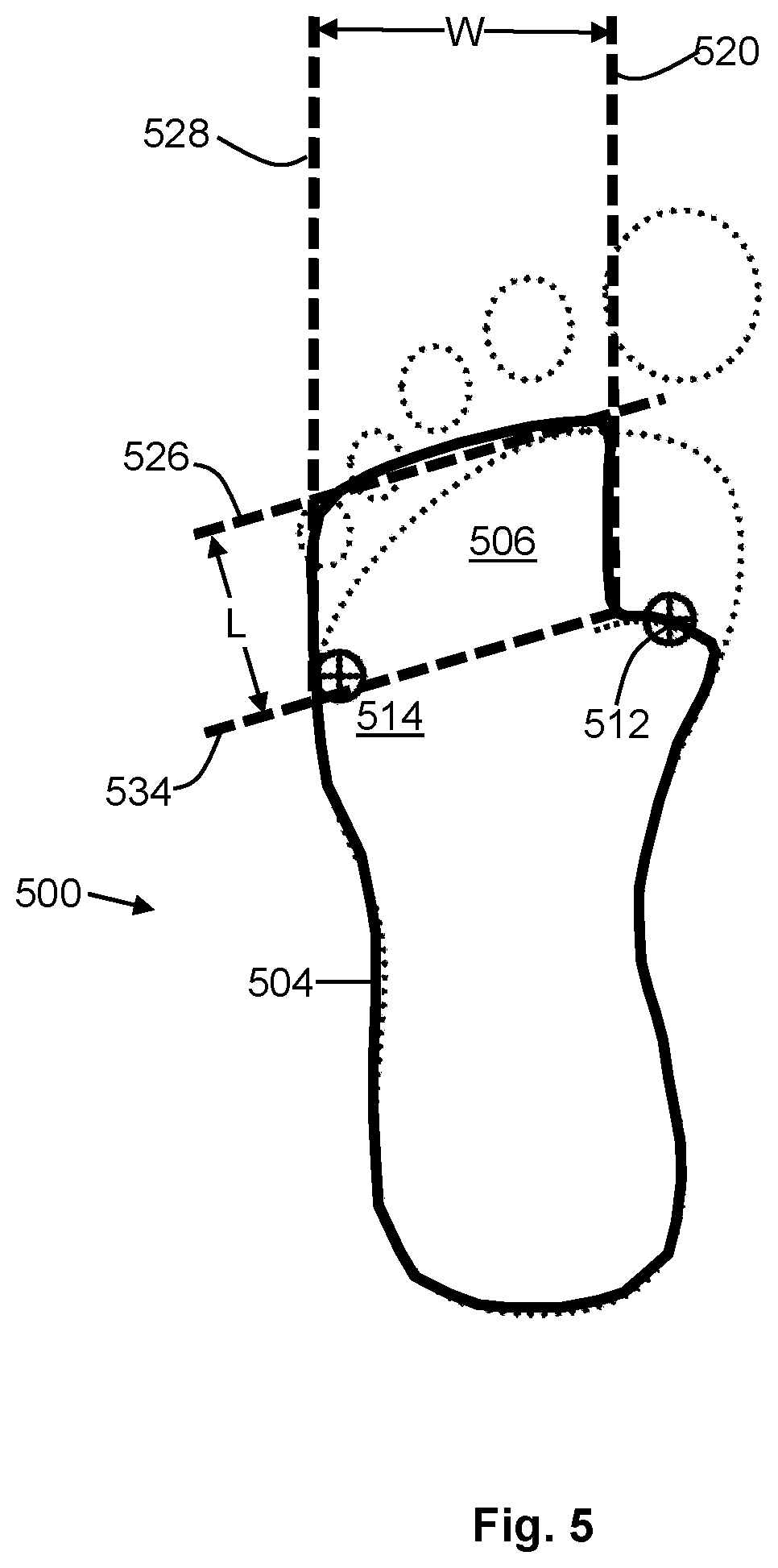 Patent US12552120 Figure 5 – Personalizing foot supports