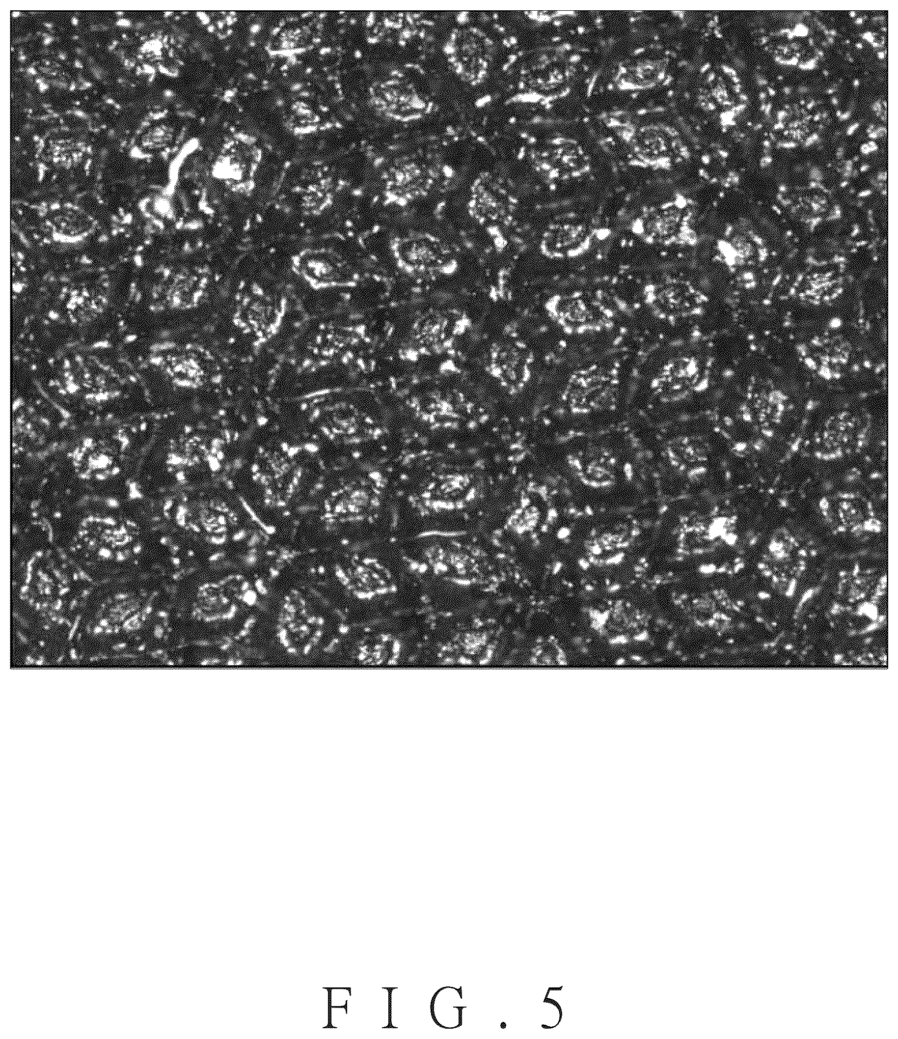Patent US12552203 Figure 5 – Structure for enhancing sidewall marking contrast and tire with the same