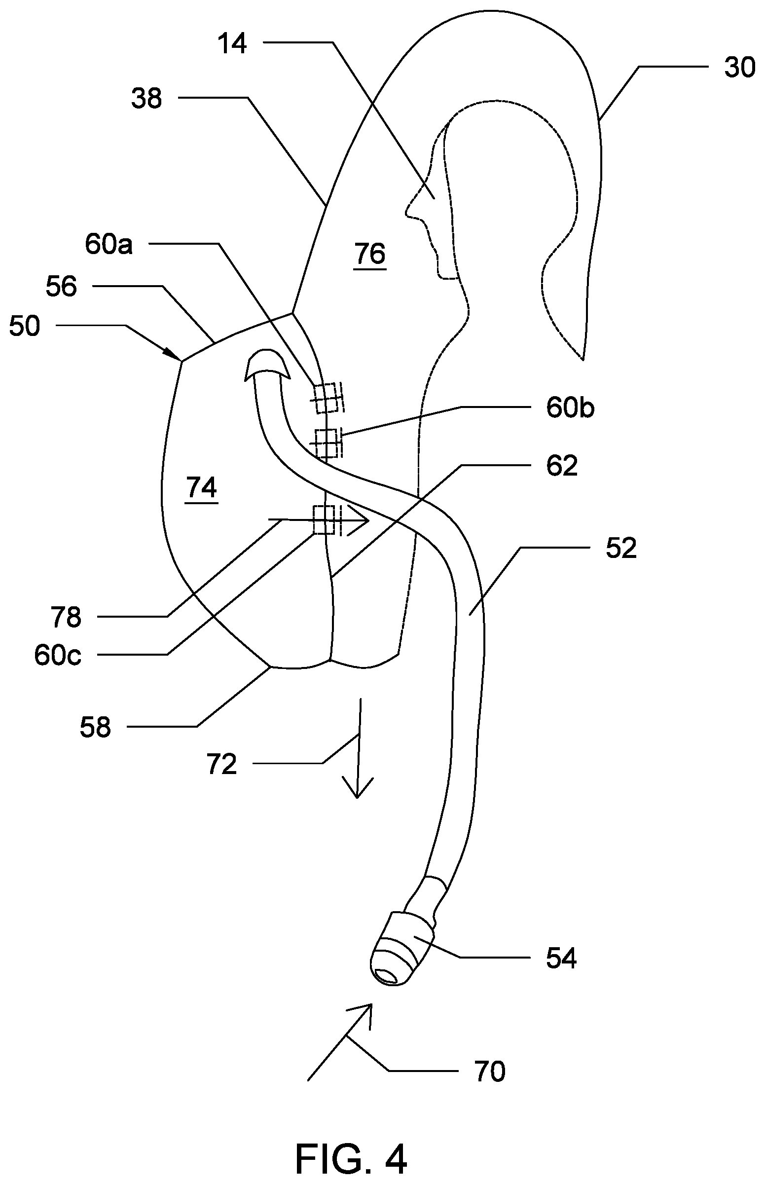 Patent US12552502 Figure 4 – Self-righting underwater escape and surface survival suit system