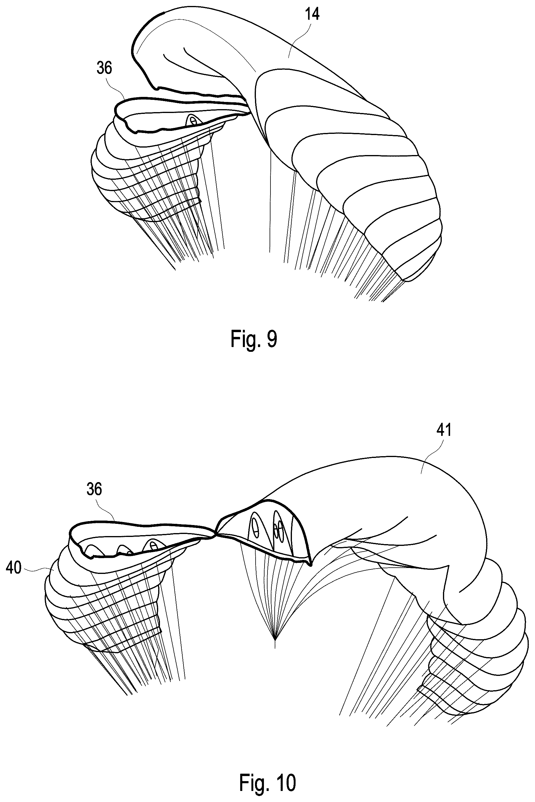 Patent US12552532 Figure 5 – Method for landing a kite system, and kite system