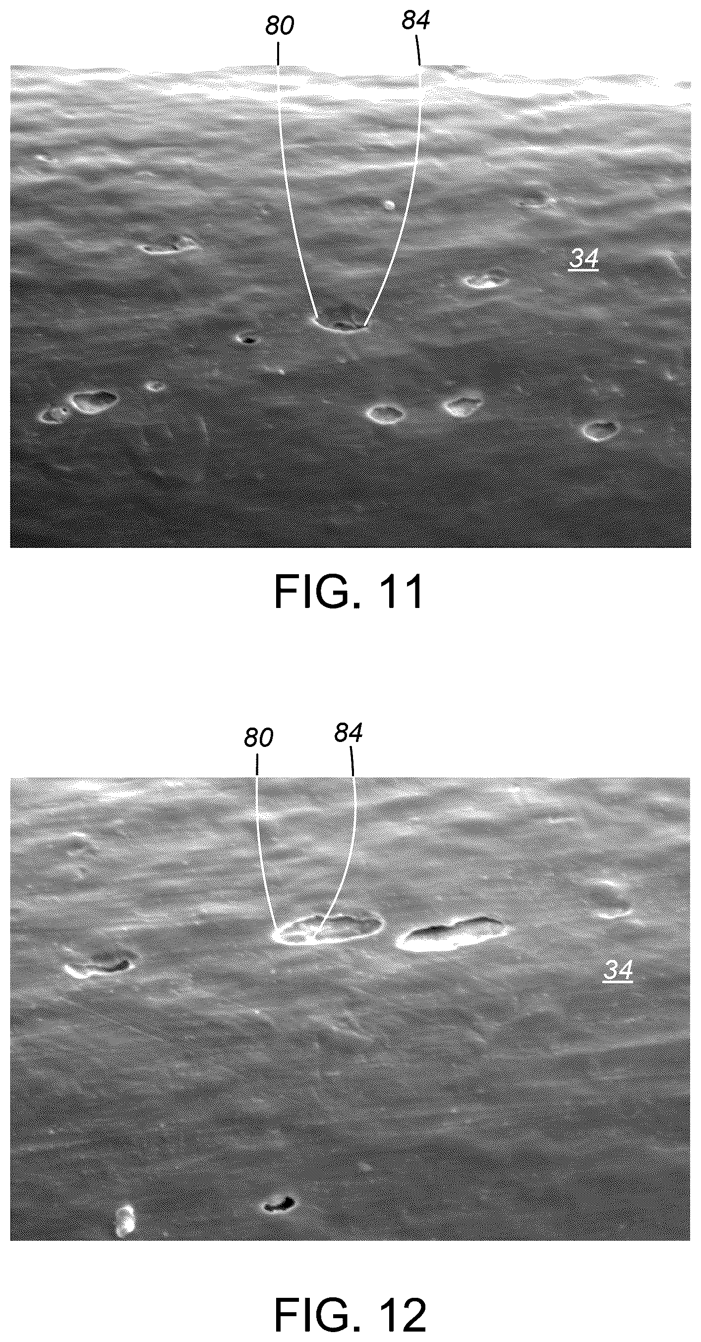 Patent US12552579 Figure 9 – Seam seal for wine in beverage cans