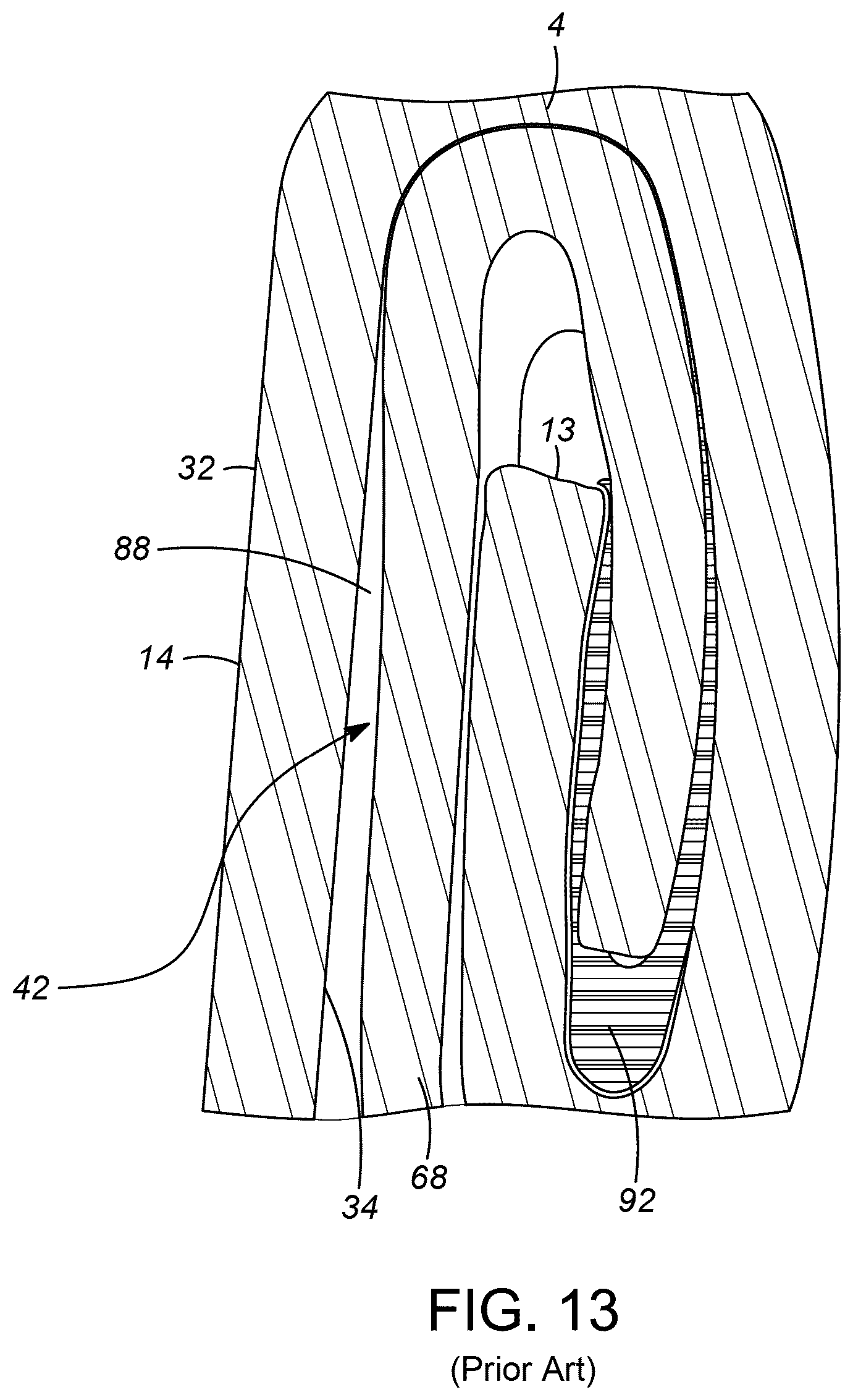 Patent US12552579 Figure 10 – Seam seal for wine in beverage cans
