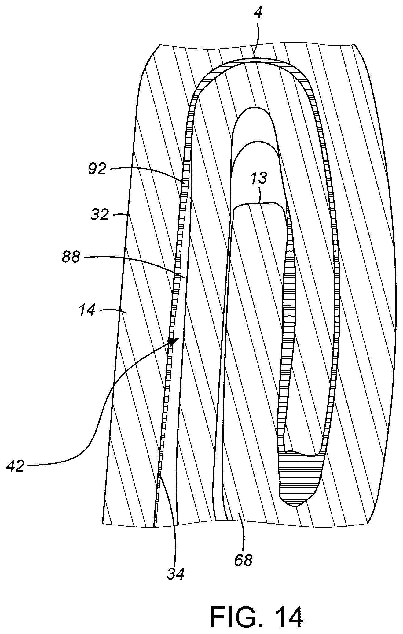 Patent US12552579 Figure 11 – Seam seal for wine in beverage cans