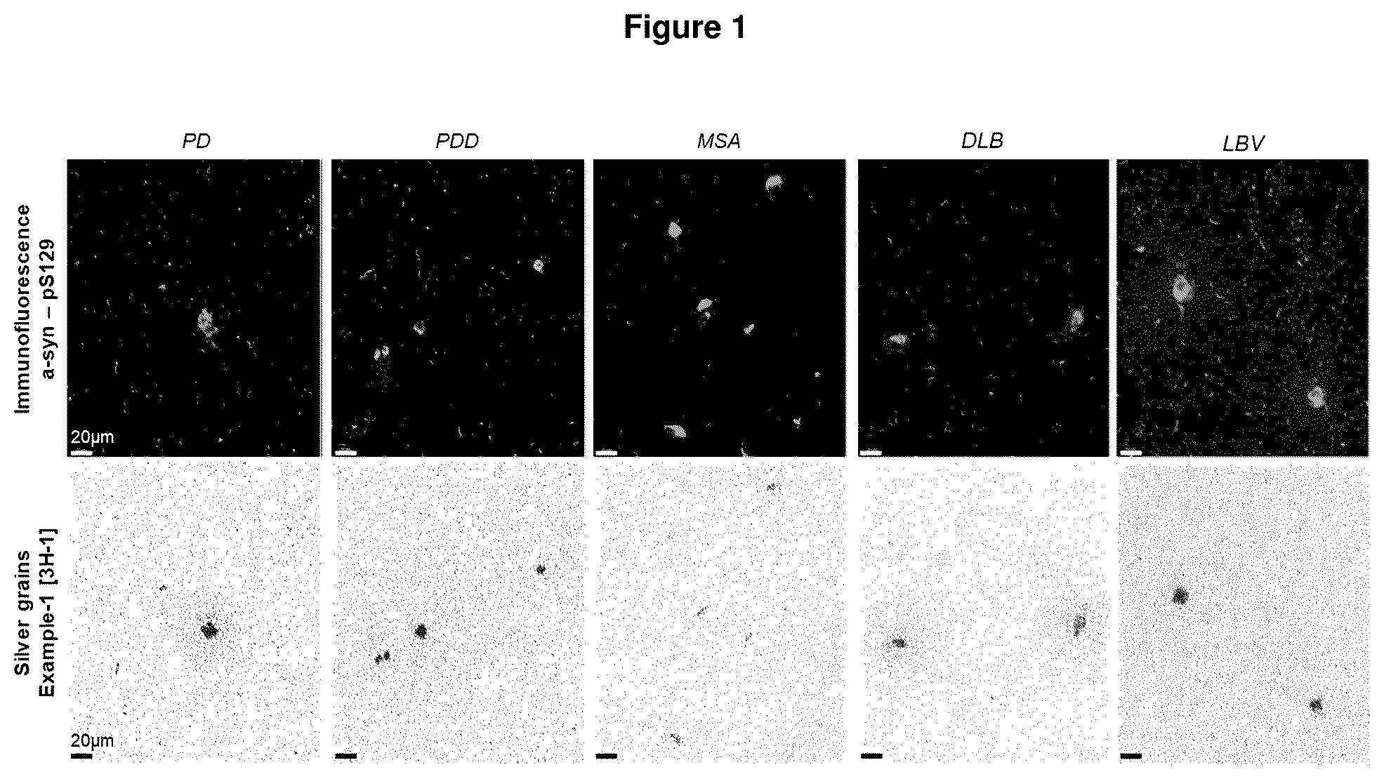 Patent US12552800 Figure 1 – Compounds for diagnosis