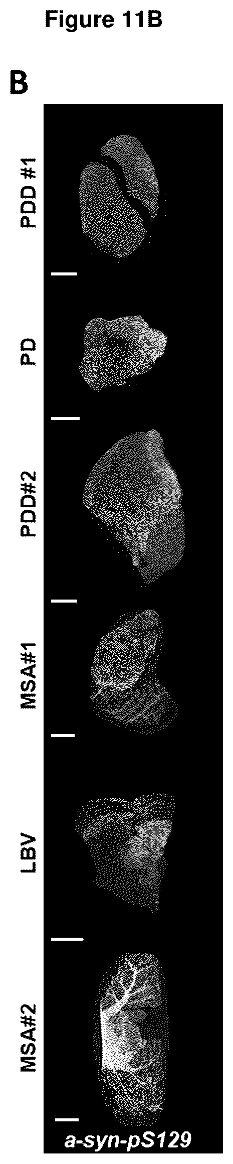 Patent US12552800 Figure 11 – Compounds for diagnosis