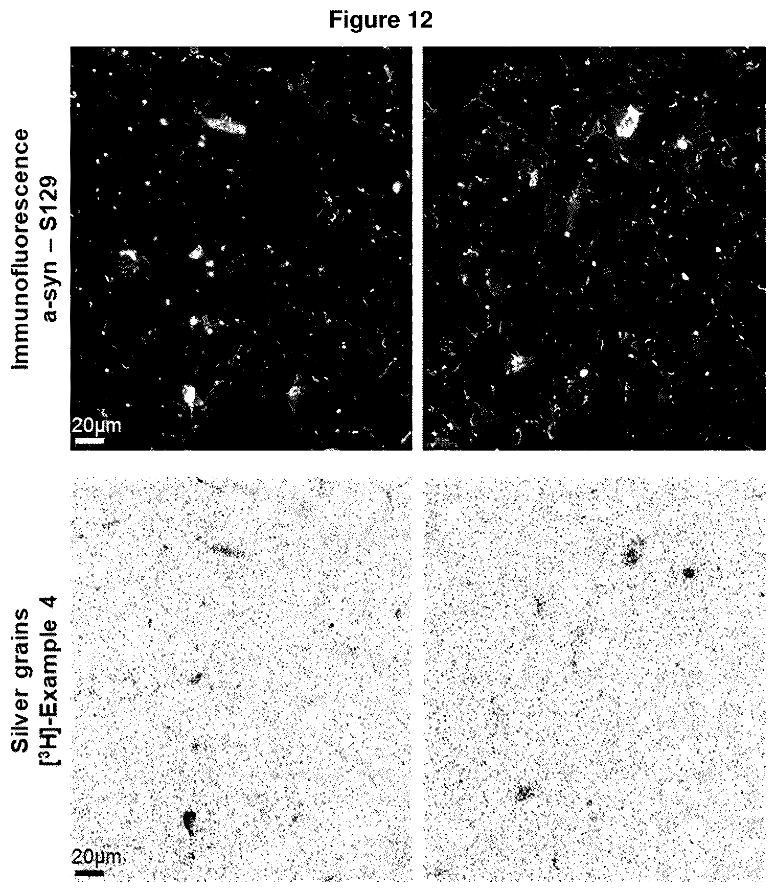 Patent US12552800 Figure 12 – Compounds for diagnosis